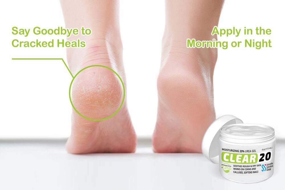 CLEAR 20, 20% Urea Gel, 4 oz w/ Tea Tree & Coconut Oil, Aloe Vera Extract, Callus & Corn Remover Moisturizes & Softens Cracked Heels, Feet, Elbows, Hands, Nails, Superior hydration to Urea Creams