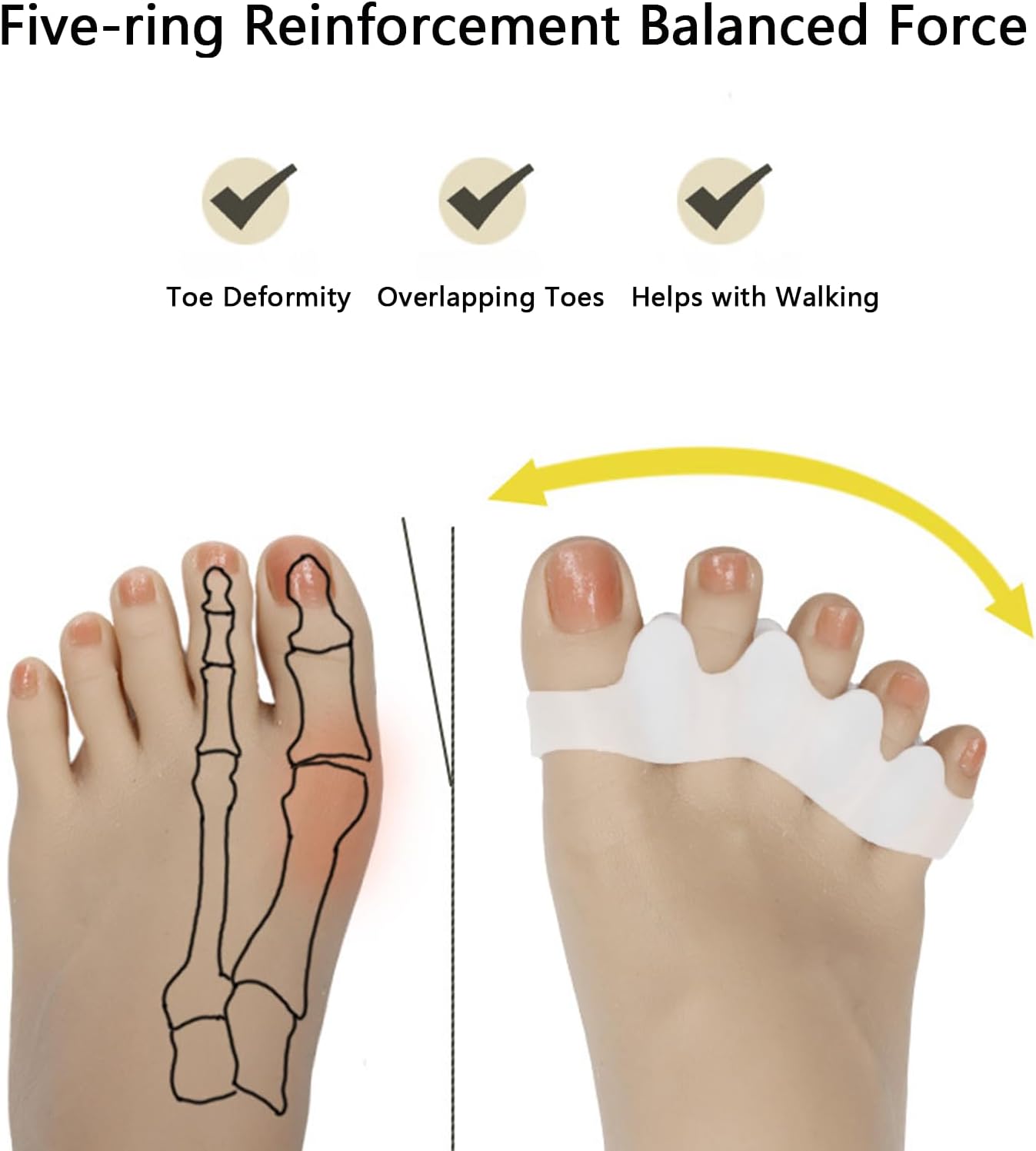 Kingjie Silicone Toe Spreaders for Men & Women - Correct Curled Toes, Bunion & Hammer Toe Support, Reusable & Washable Adjustable Unisex Toe Spacer(4 Pack) (White + Skin Color)