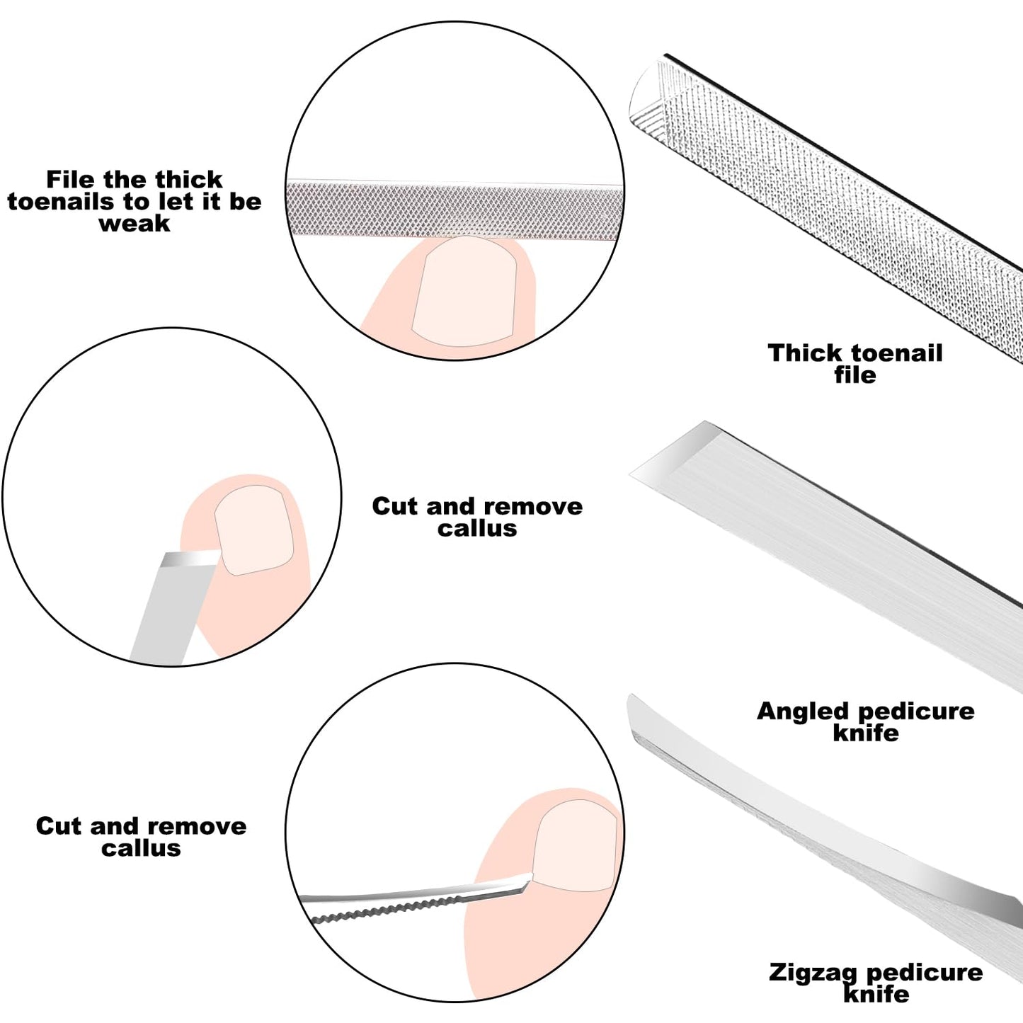 ZIZZON 7 Pcs Ingrown Toenail File and Lifters Set, Stainless Steel Ingrown Toenail Removal Kit, Under Nail Cleaner Pedicure Tools