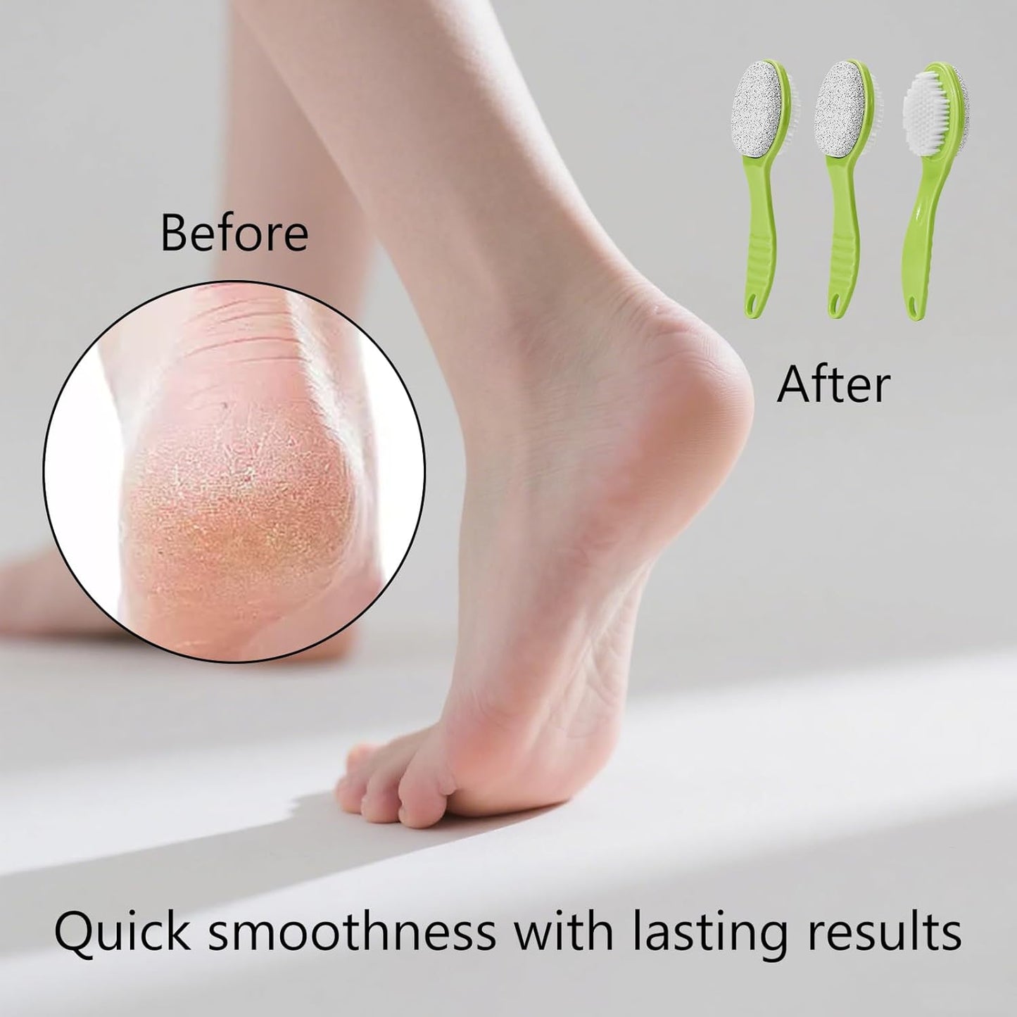 Foot Callus Remover, Double-Sided Pumice Stone Brush for Feet, 3 Pack Foot File Scrubber for Home Feet Care, Multi Purpose Pedicure Tools with Handle for Dead Skin Remover in Shower, Green