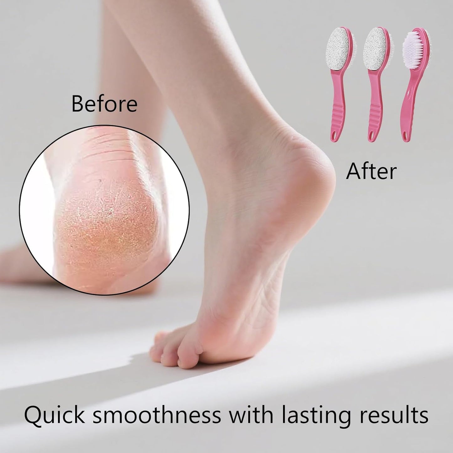 Foot Callus Remover, Double-Sided Pumice Stone Brush for Feet, 3 Pack Foot File Scrubber for Home Feet Care, Multi Purpose Pedicure Tools with Handle for Dead Skin Remover, Rose Pink