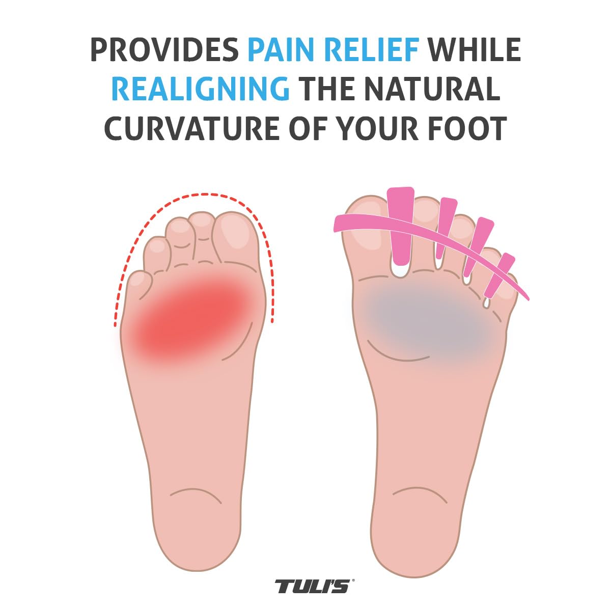 Tuli’s Soft Moves Adjustable Toe Separators, Silicone Toe Spacers for Alignment, Bunions, Hammertoes, Plantar Fasciitis, Yoga, Morton’s Neuroma, and Foot Health, One Size Fits All, Pink