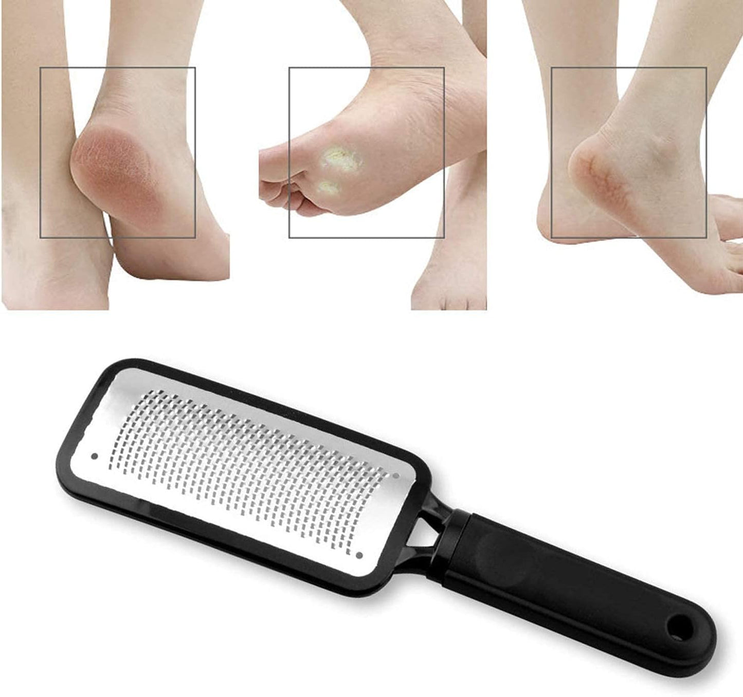 Professional Foot Files Callus Remover,Foot Scrubber for Dead Skin,Stainless Steel Foot Rasp-Black(1 Pack)