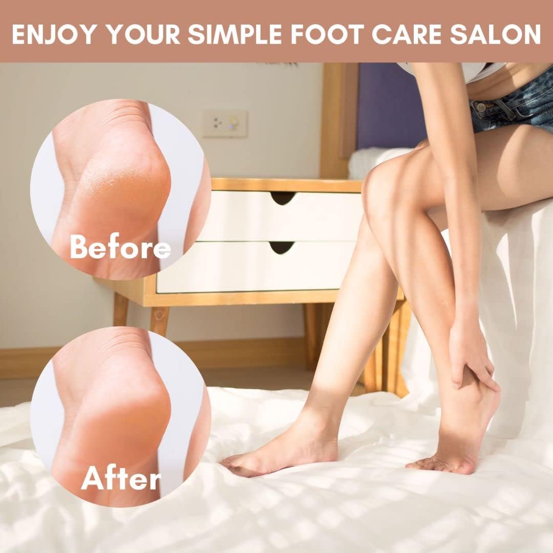 Makartt Foot File: Colossal Foot Scrubber Metal Foot Spa Pedicure Tools Callus Remover for Feet Dead Skin Care Removers Scraper Professional Rasp Callus Shaver Removal