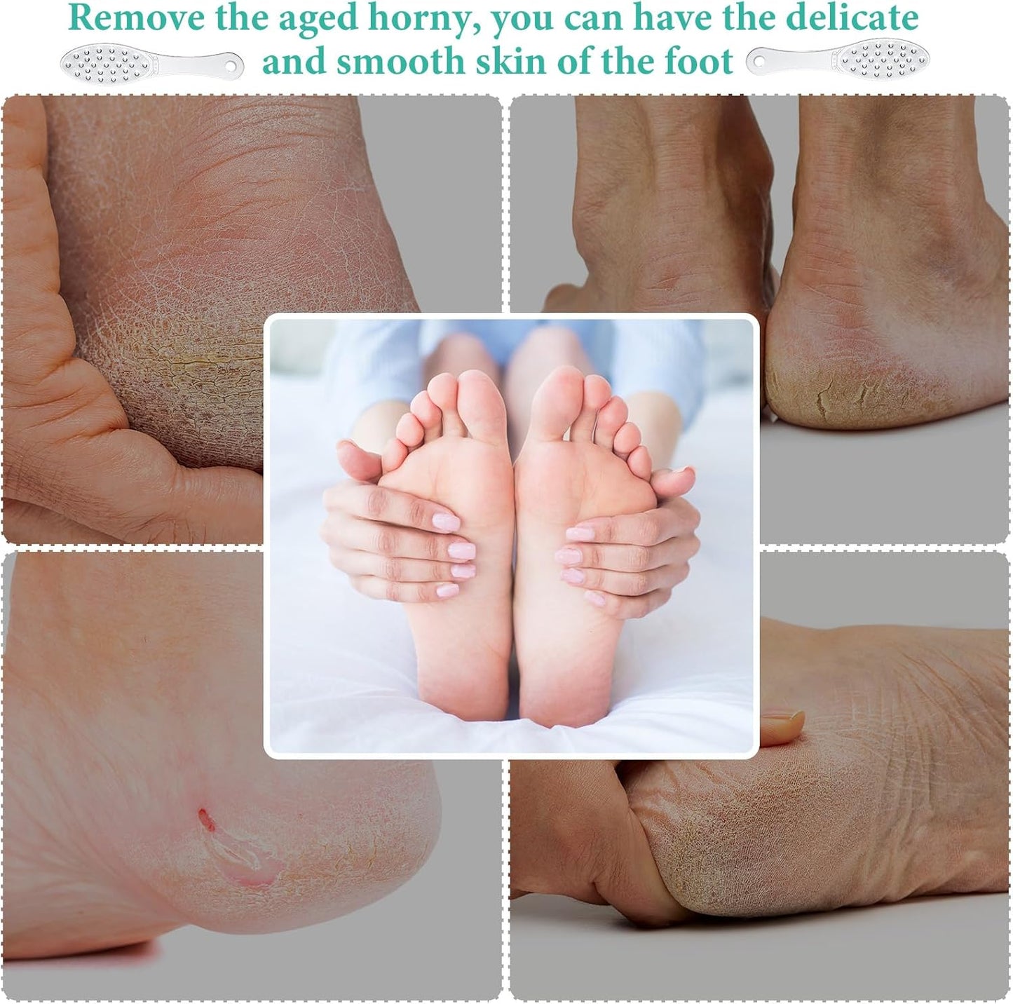 4 Pcs Stainless Steel Foot Scraper Metal Foot File Double Sided File Callus Remover Professional Feet Rasp Scrubber for Wet or Dry Skin Easy to Clean Pedicure Tool Heel
