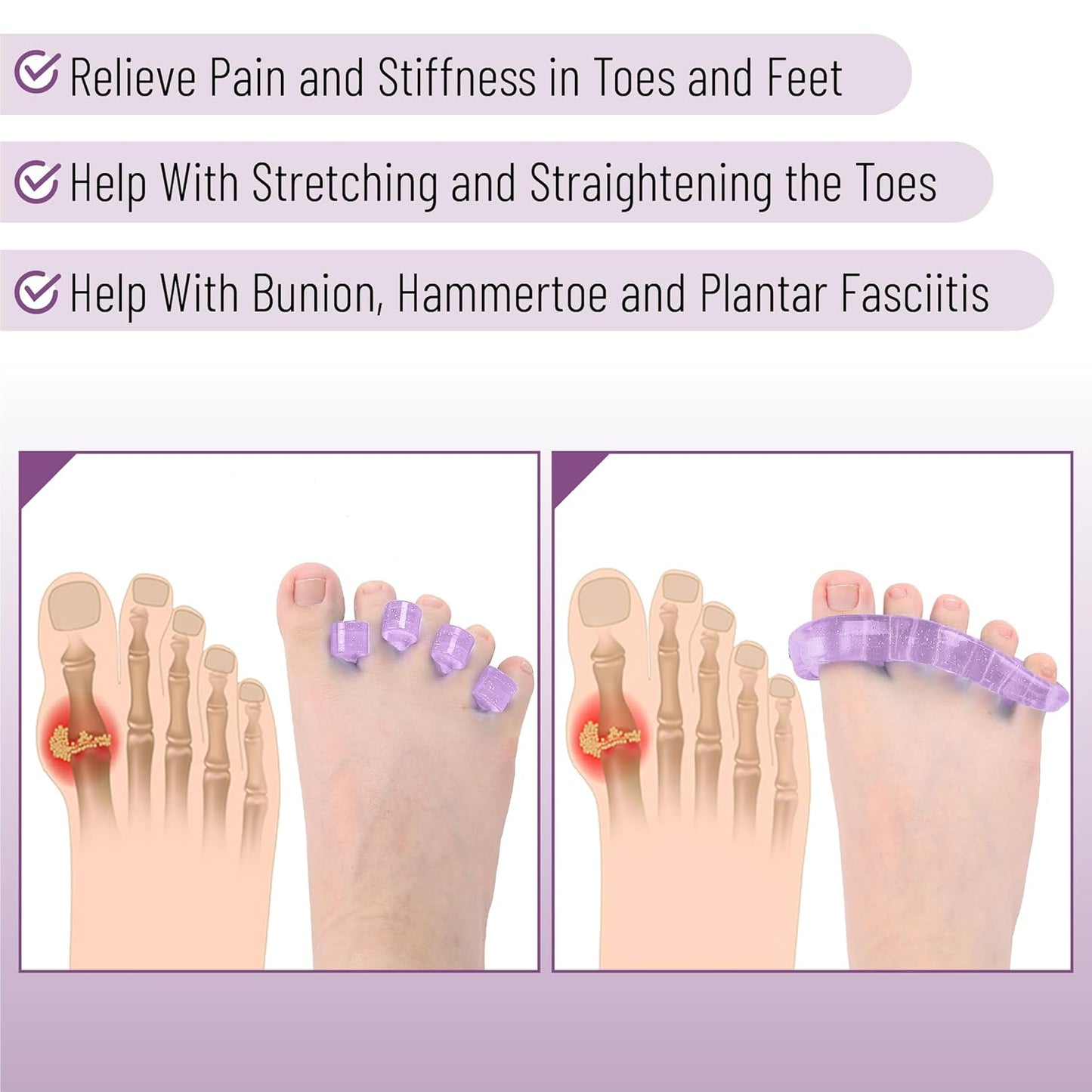 Dr. JK- ToePal Gel Toe Separator, 4 Pairs, Toe Spacers, Bunion Corrector, Christmas Gifts
