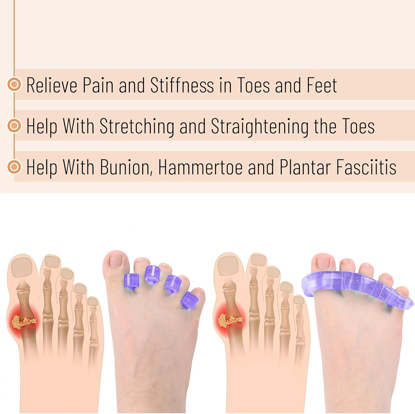 Dr. JK- ToePal Gel Toe Separator, 2 Pairs, Toe Spacers, Bunion Corrector, Christmas Gifts