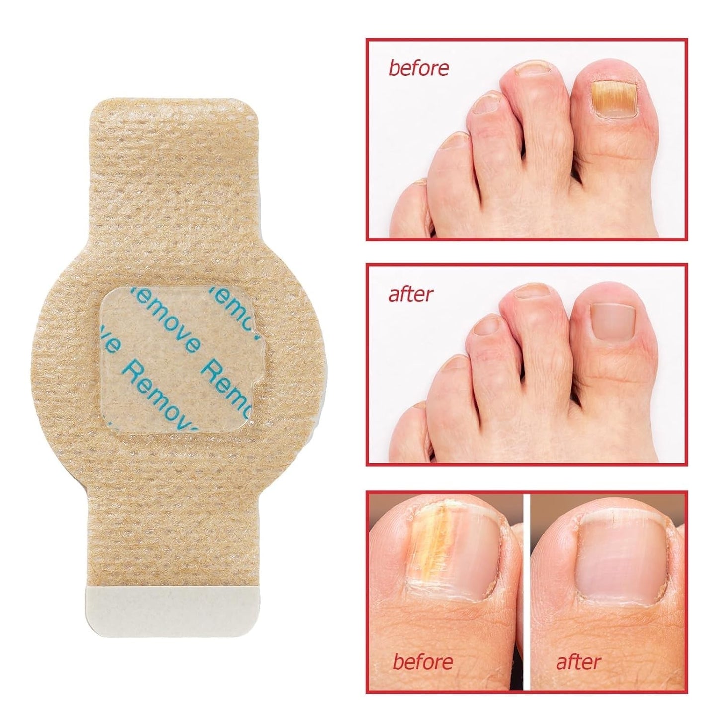 Nail Patches,21 Patch,Nighttime Nail Patches,for Damaged Nails Foot Nails Repair and Care,Strengthens Brittle Nail