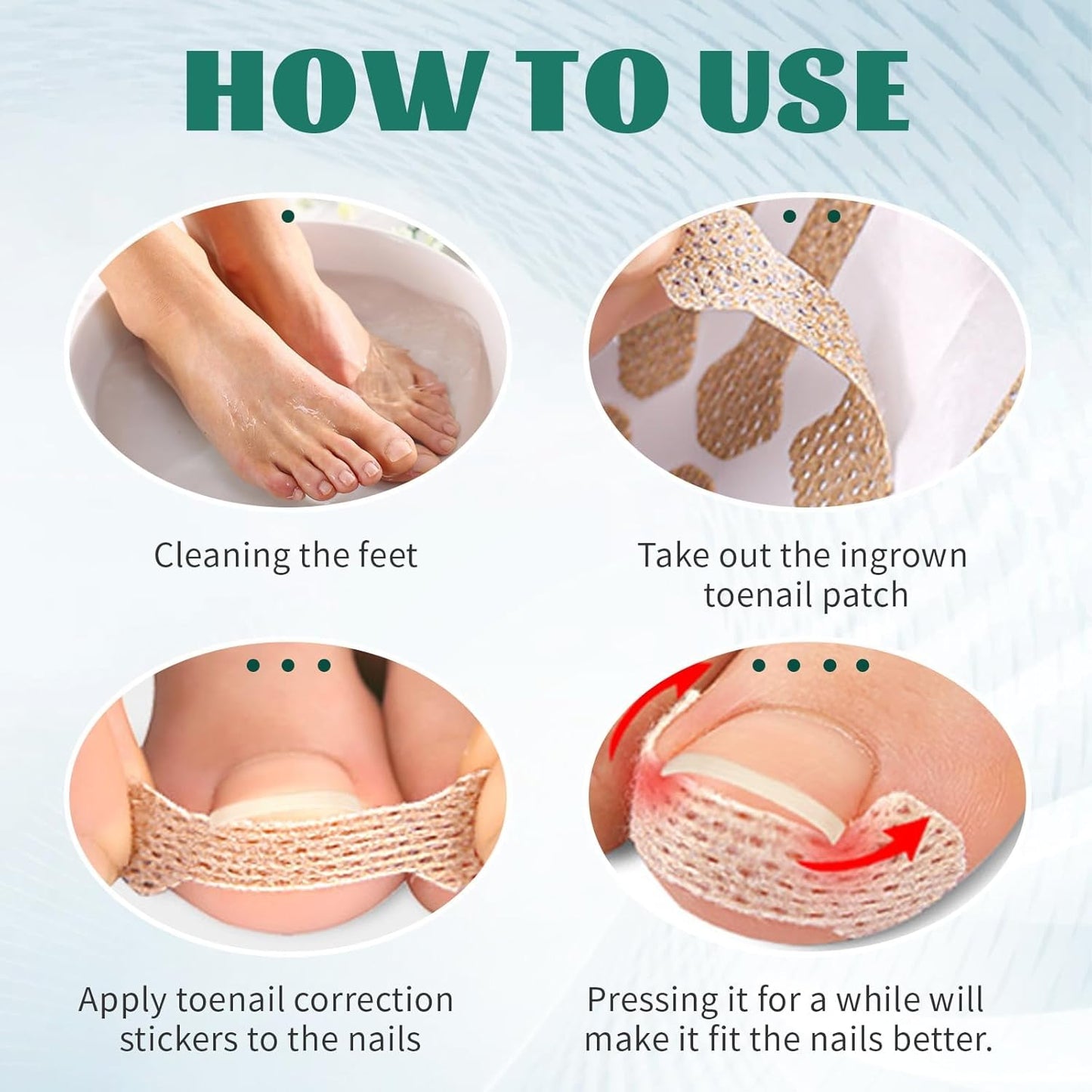 Ingrown Toenail Treatment, 60Pcs Breathable Ingrown Toenail Strips,Painless Ingrown Toenail Tool, Professional Pedicure for Ingrown Toenail, Toenail Corrector Patch