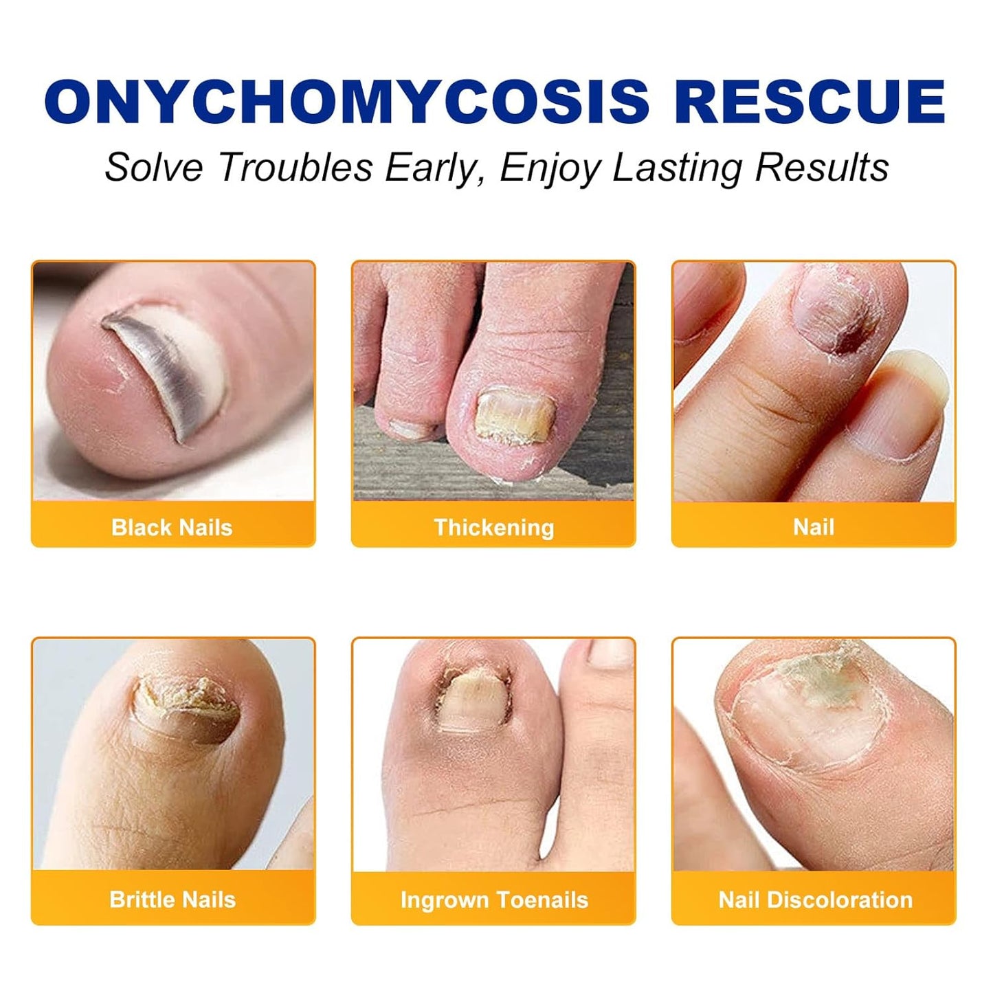 Toenail Treatment Extra Strength-8-Hrs Overnight Nail Repair,ingrown toenail treatment,Strengthens Brittle Nails,Improves Texture & Thickening Hypoallergenic Easy (64 Patch)