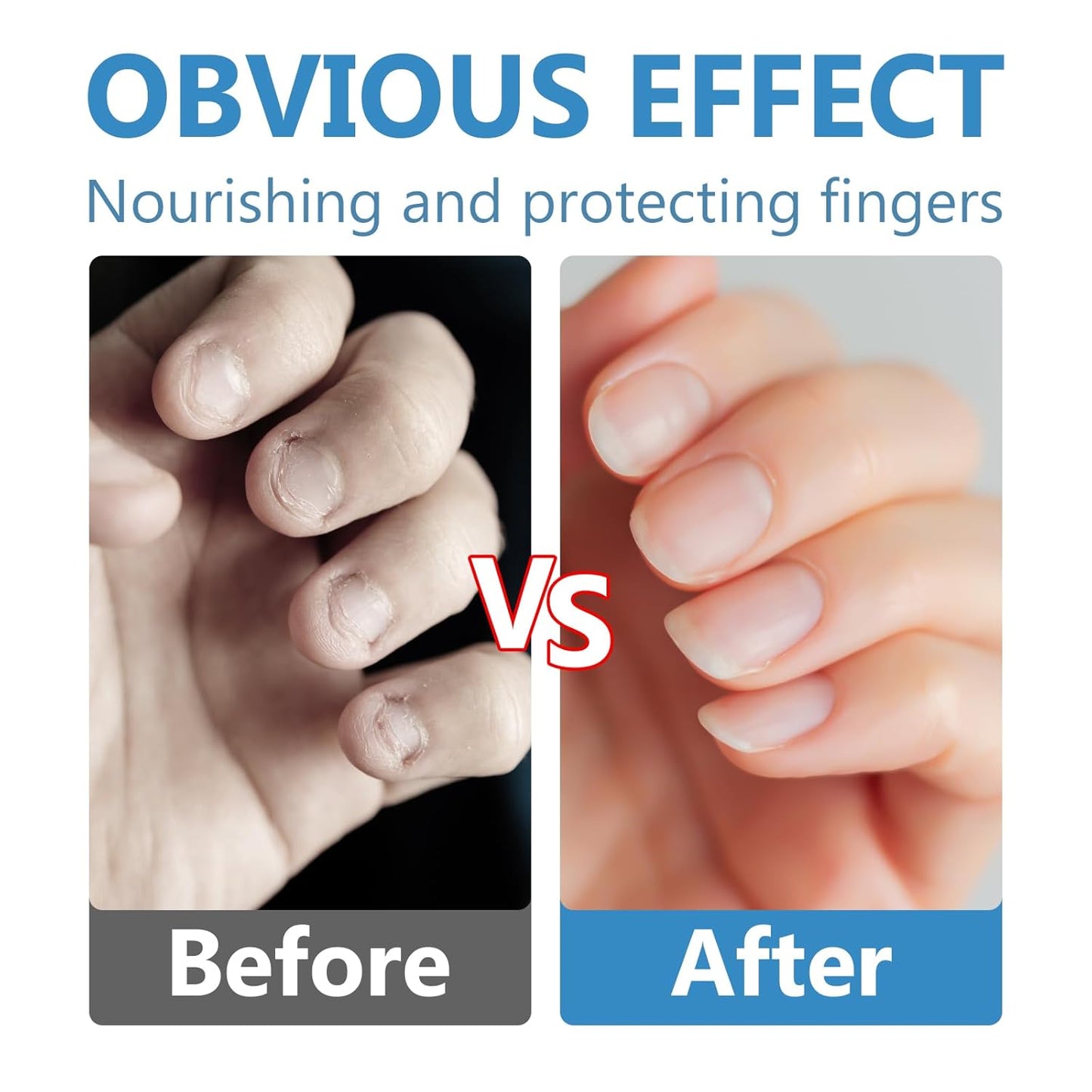 Nail Biting Prevention-Nail Biting Treatment for Kids-Anti-Nail Biting Thumb Cream for Kids-100% Natural Bitter Formula-No Additives-Protects Nails Healthy Nail Growth-Safe for Children, 2.11Fl.Oz
