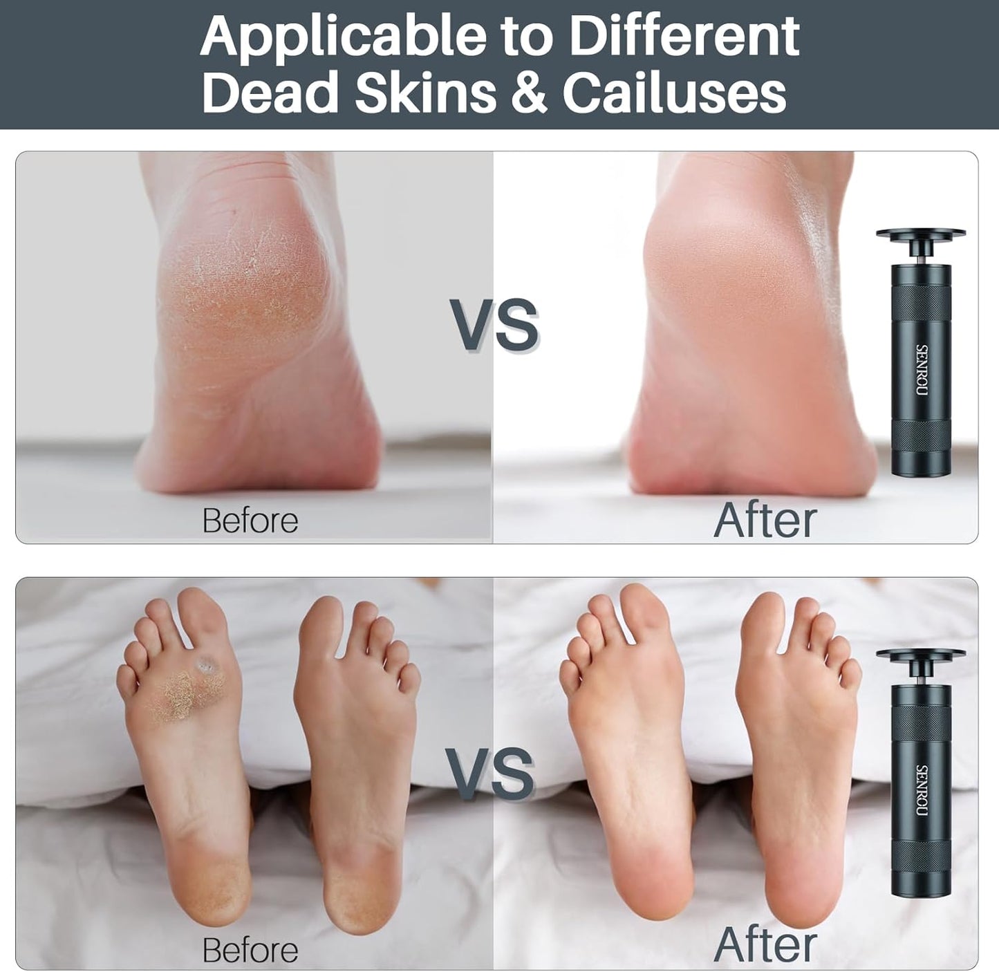 Callus Remover for feet,Nail Filer,Electric Foot Filer with 60Pcs+12Pcs Sandpaper Discs,Gifts for Woman/Men Birthday Christmas Stocking Stuffers Foot Repair Tool-Grey