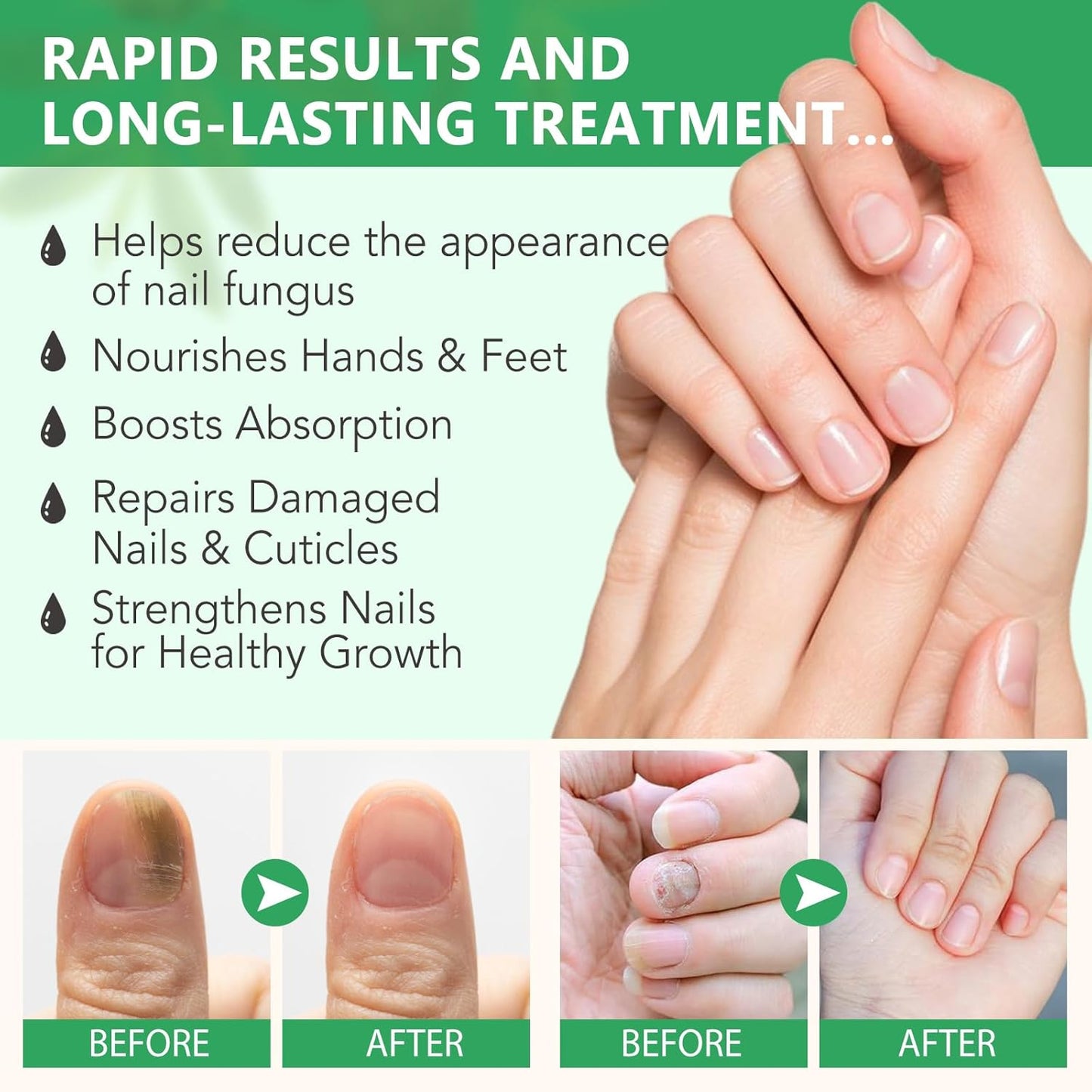 Ginger Nail Growth Strengthener Serum – Ginger-Infused Nail Repair Oil for Care, Natural Nail and Strengthener Solution