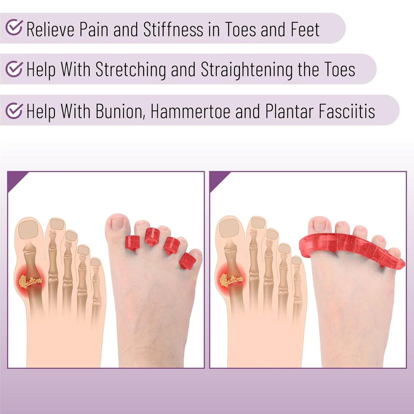 Dr. JK- ToePal Gel Toe Separator, 4 Pairs, Toe Spacers, Bunion Corrector, Turquoise & Pink, Christmas Gifts
