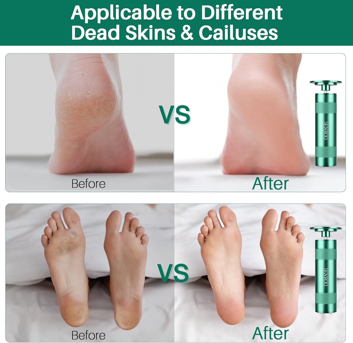 Electric Foot Callus Remover, 2-in-1 Electric Foot Filer/Nail Filer, Callus Remover for Feet with 60Pcs+12Pcs Sandpaper Discs,Holiday Gift Foot Repair Tool, Green
