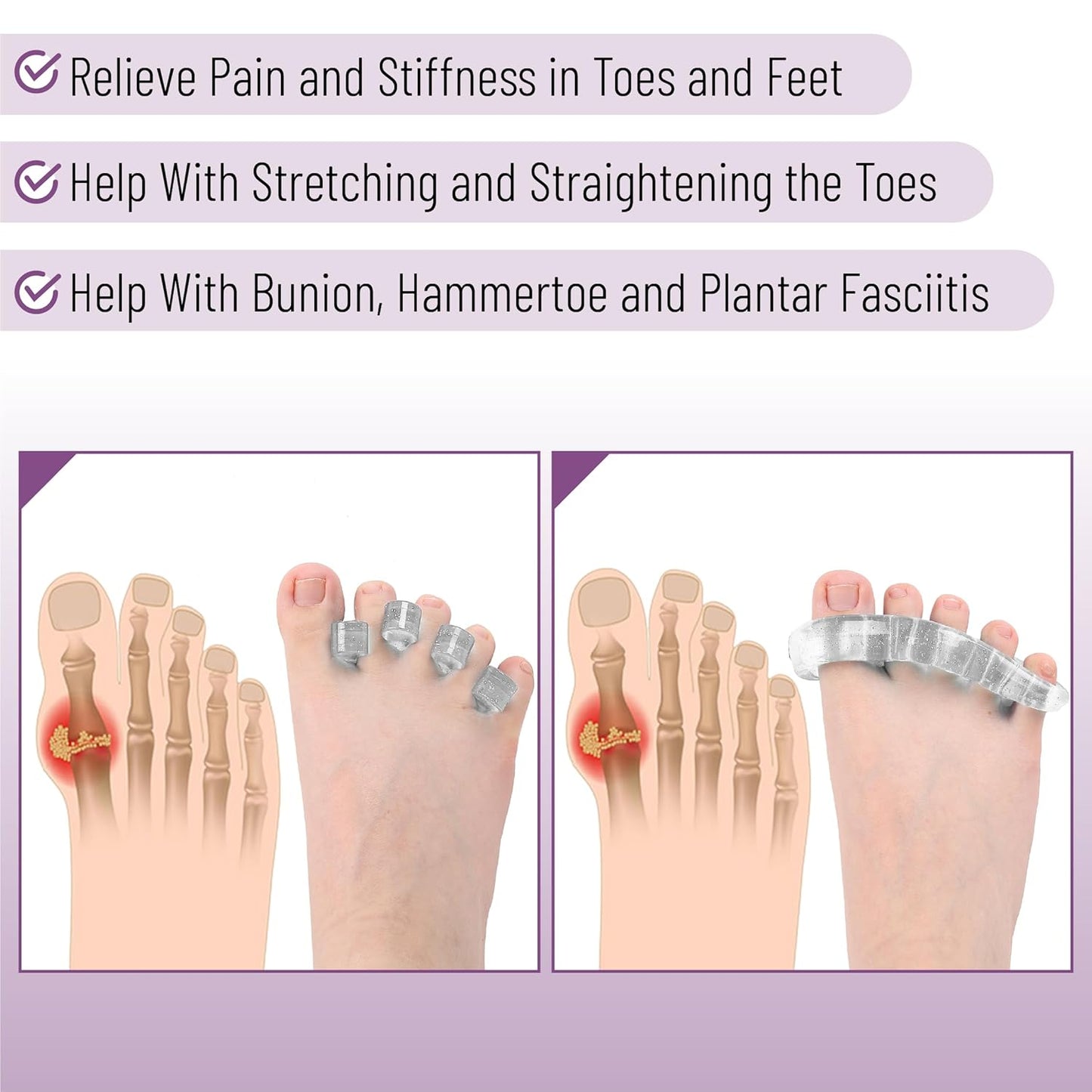 Dr. JK- ToePal Gel Toe Separator, 4 Pairs, Toe Spacers, Bunion Corrector, Christmas Gifts