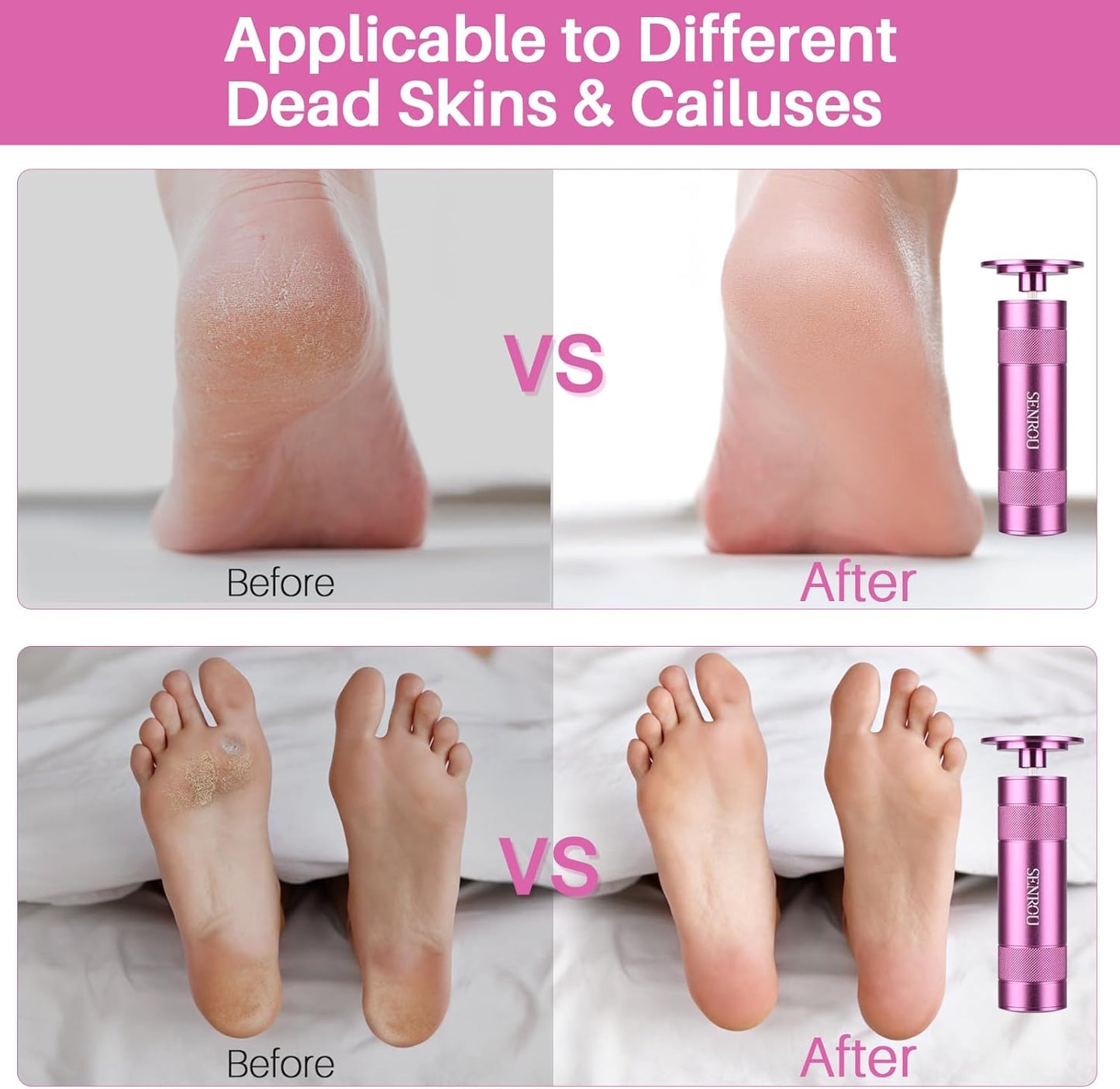 Electric Foot File Callus Remover, 2-in-1 Pedicure Tool with 60 Sandpaper Discs, Adjustable Speed