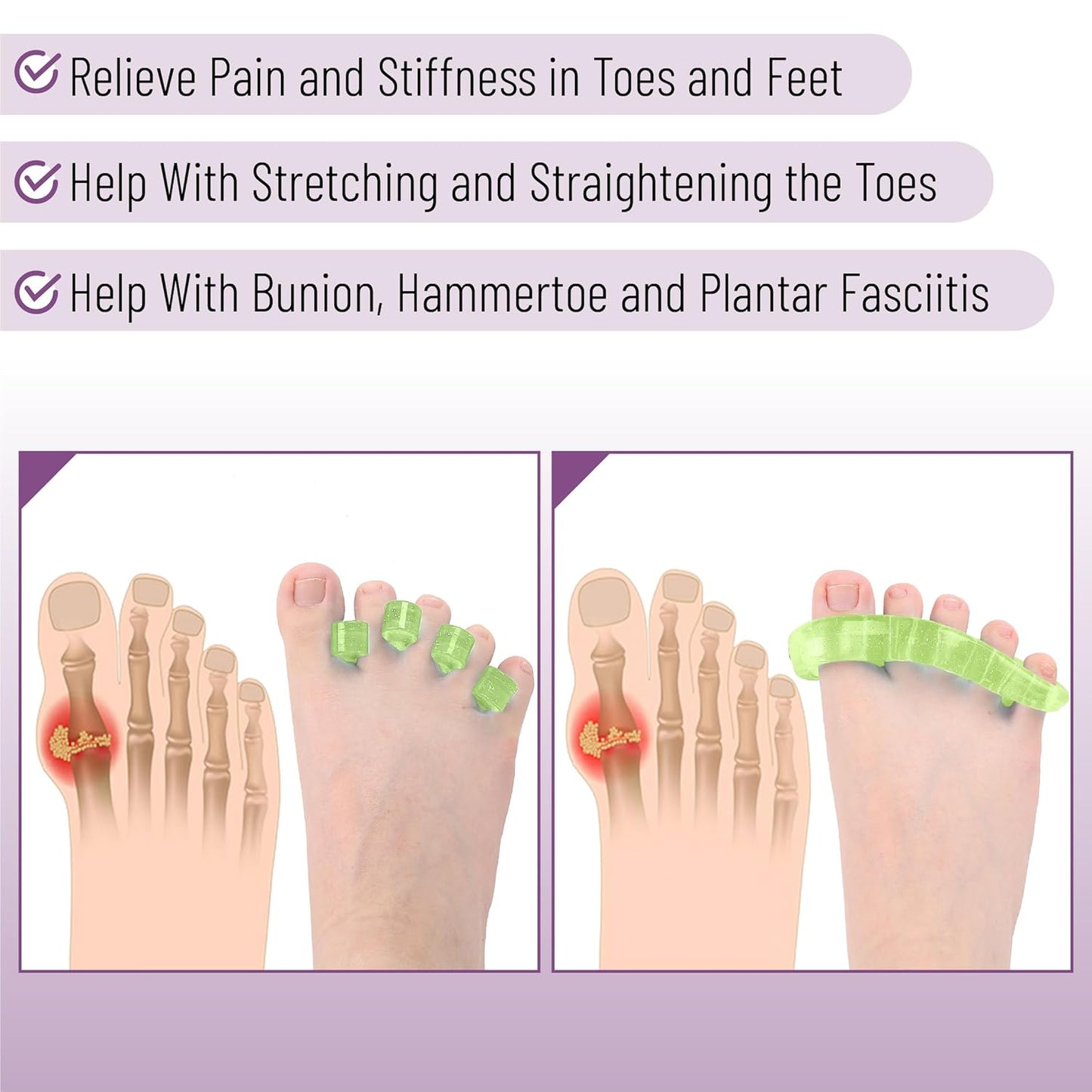 Dr. JK- ToePal Gel Toe Separator, 4 Pairs, Toe Spacers, Bunion Corrector, Christmas Gifts