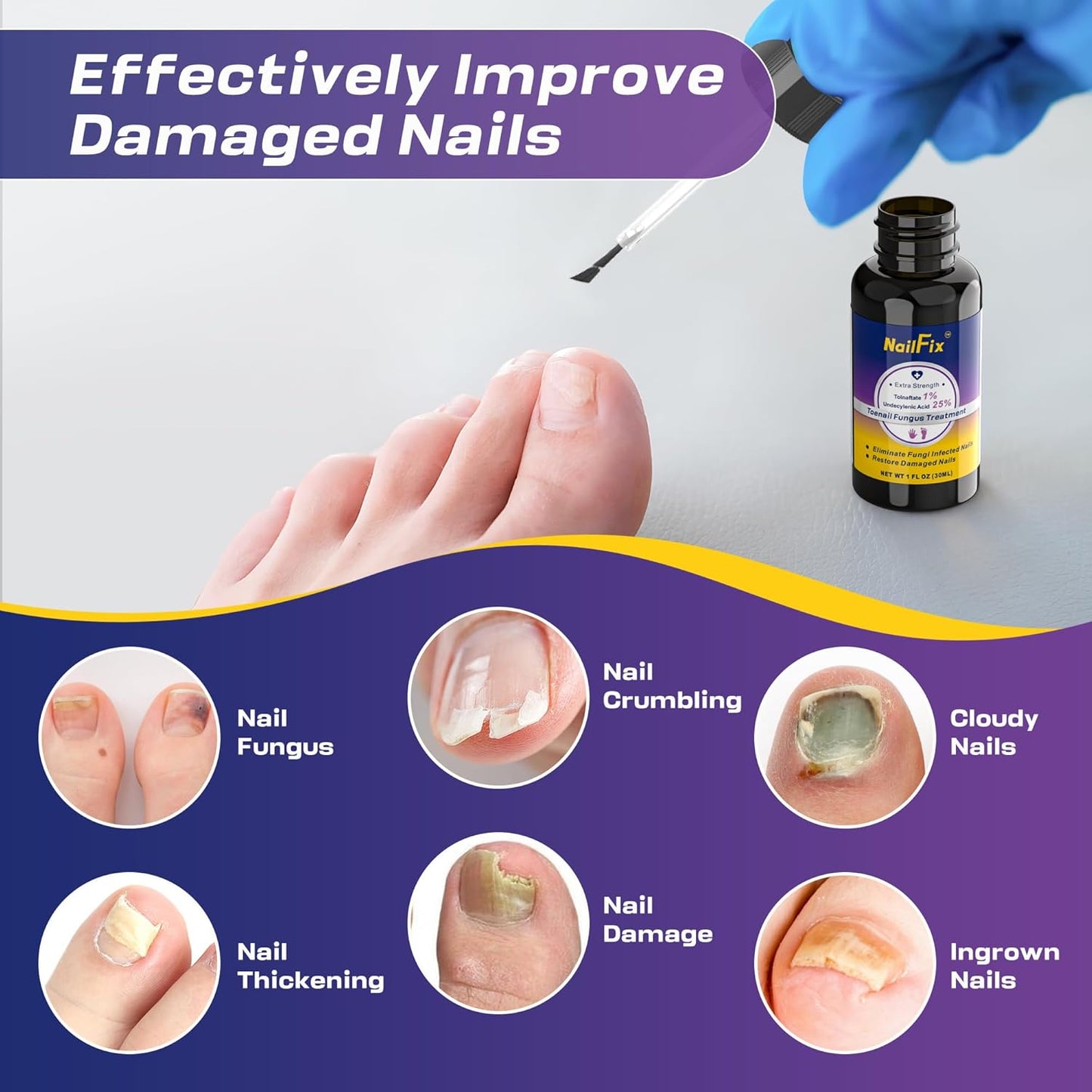 Toenail Fungus Treatment Extra Strength - Upgraded Toe Nail Fungus Treatments, Antifungal Nail Treatment with 25% Undecylenic Acid & Tea Tree Oil - Damaged Nails Foot Fungus Treatment Extra Strength
