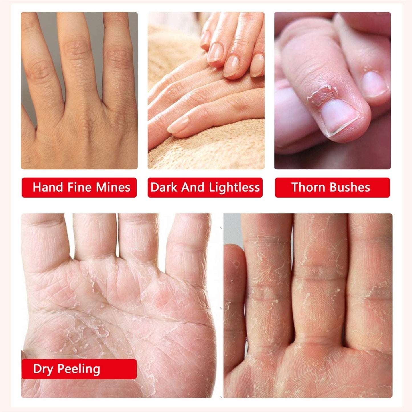 Hand Peel Mask Moisturizing Gloves 5Pack, Hydrating Hand Masks Repair Dry Cracked Hands, Skin Moisturizer for Soft and Smooth Touch