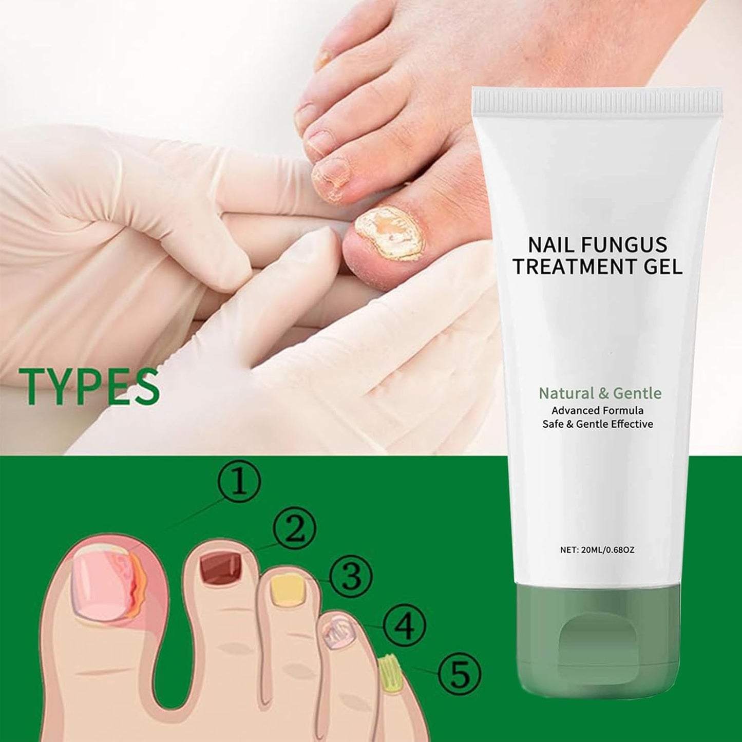 Nail Treatment Gel, Nail Growth Serum for Repair & Strengthener (1)
