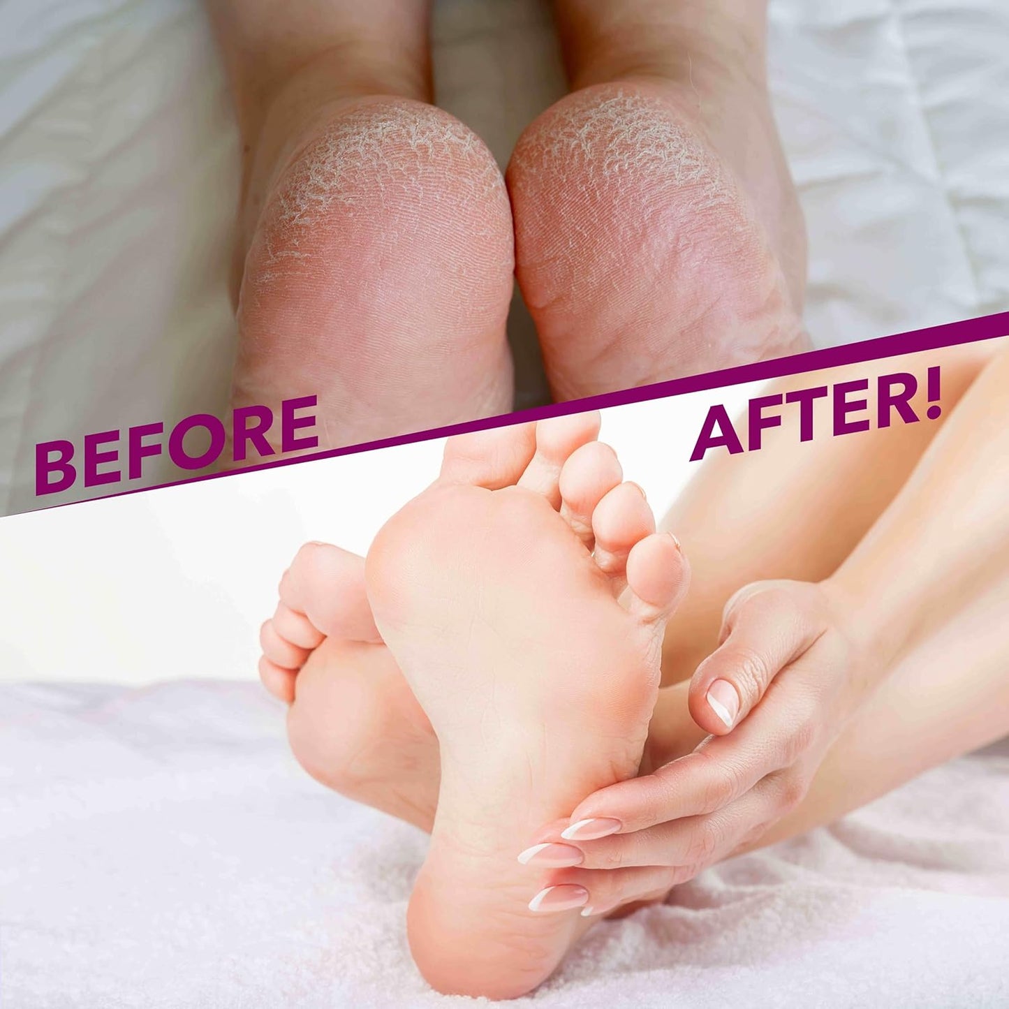 Gel Spa Moisturizing Socks - 1 Pair Spa Socks Infused with Essential Oils to Soften Skin & Lock in Moisture | Non-Slip Grip Gel Socks for Dry, Cracked Feet
