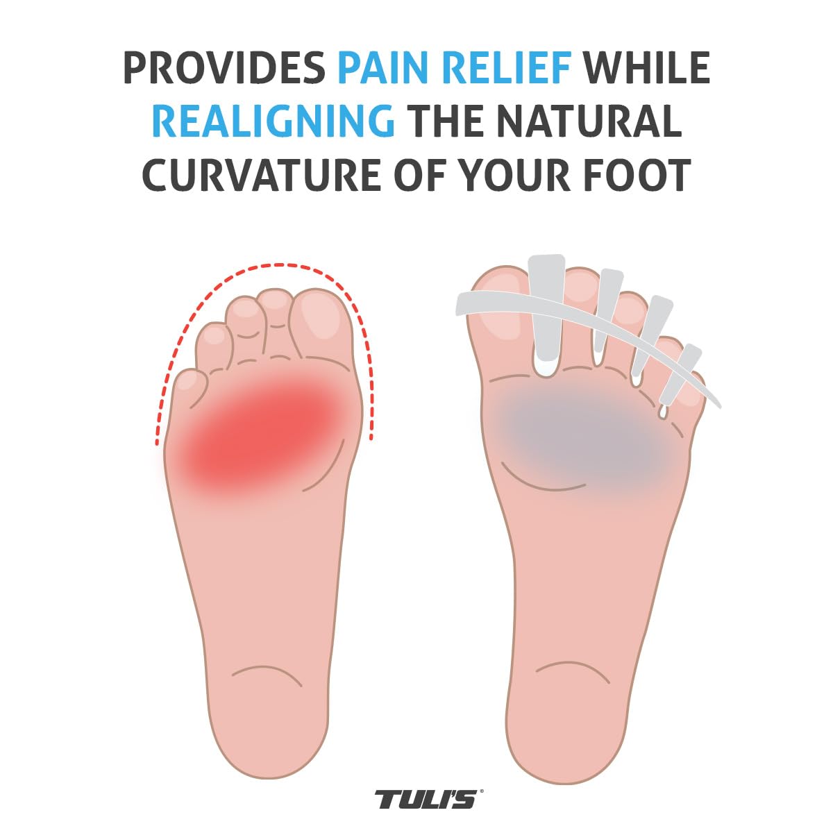 Tuli's Soft Moves Adjustable Toe Separators, Silicone Toe Spacers for Alignment, Bunions, Hammertoes, Plantar Fasciitis, Yoga, Morton’s Neuroma, and Foot Health, One Size Fits All, White
