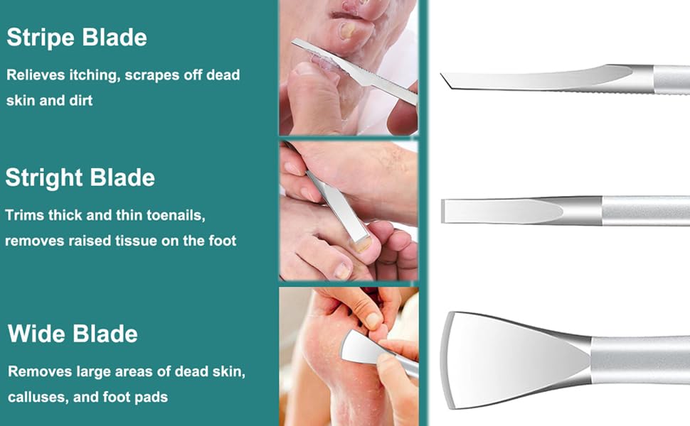 Ingrown Toenail Removal Kit, Pedicure Tools Kit Professional Knife Set Stainless Steel Ingrown Toenail Tool Foot Care Tools Nail Cuticle Remover (5 Pcs Set)