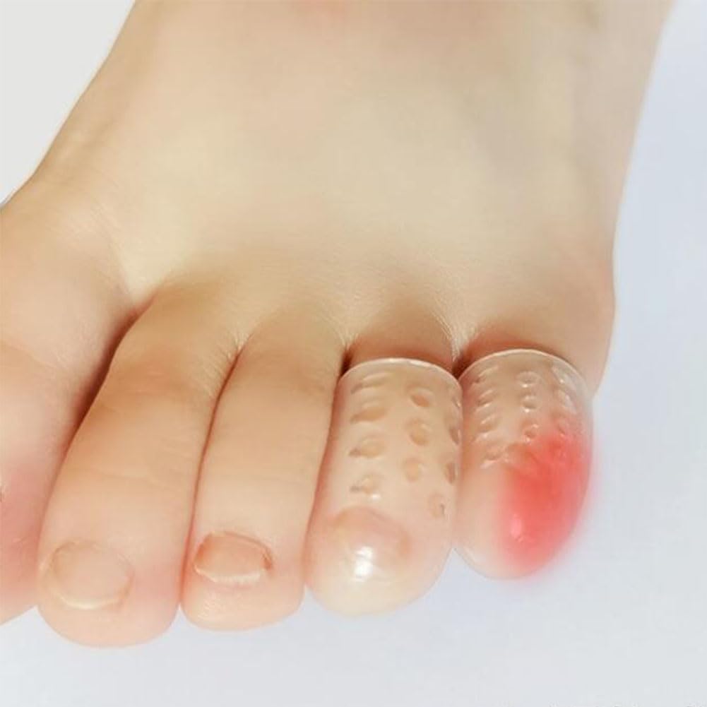 20 Pack Bunion Relief Pads & Gel Toe Separators - Silicone, Breathable, Anti-Friction Cushions for Pain & Protection Unisex Foot Care for Bunions, Corns, Calluses