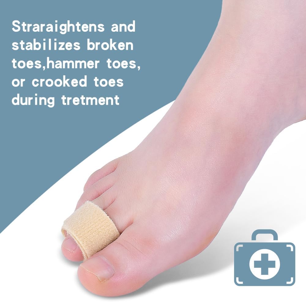 Medical-all Toe Separators for Overlapping Toes, Bunions, Big Toe Alignment, Corrector and Spacer, Reusable Fabric Buddy Wraps for Broken Toes, Hammertoe Straightener (BEIGE)