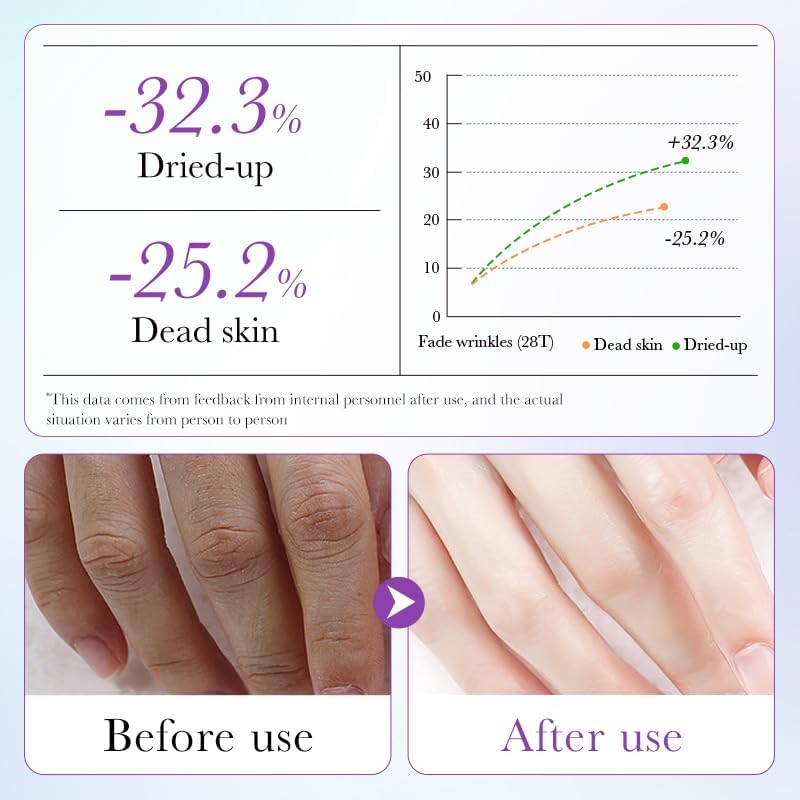 5 Pairs Hands Moisturizing Gloves, Lavender Essence Hand Skin Repair Renew Mask Infused Collagen, Vitamins + Natural Plant Extracts for Dry, Aging, Cracked Hands