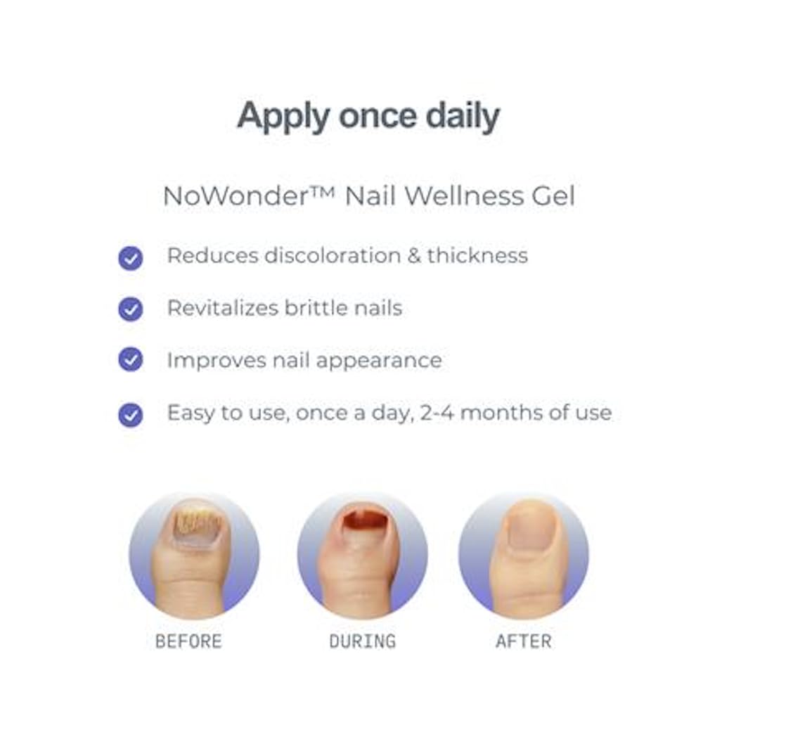 NoWonder Nail Wellness Gel | Nitric Oxide Creating Nail Renewal Solution | Supports Clearer, Healthier Nails | Non-Prescription, Safe & Easy-to-use, Nail Care, with Visible Results