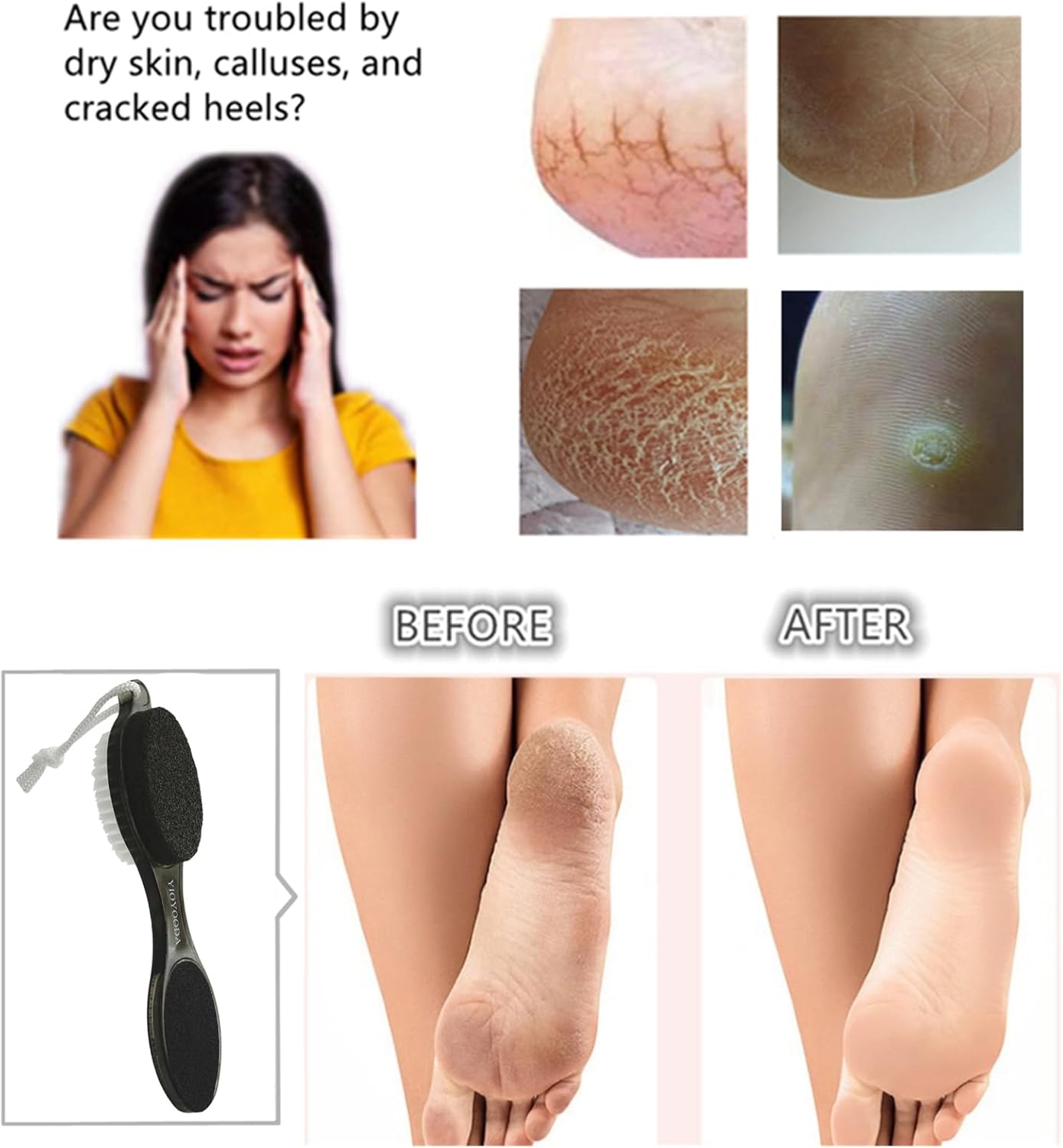 Foot File Callus Remover 4-in-1, 2 Pcs Feet Scraper Pedicure Tools with Pumice Stone, Scrubber Brush, Foot Rasp and Sand Paper, Double Sided Multi Purpose, Clear Black and Pink