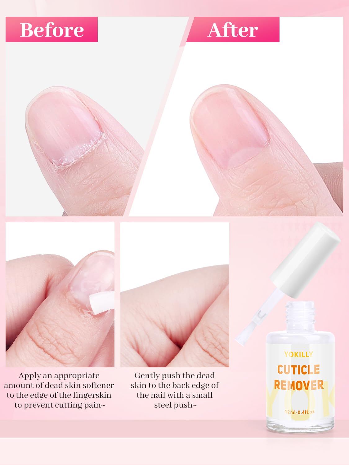 Yokilly Nail Soaking Bowl, Soak Off Gel Polish Remover Manicure Bowl, Acetone Nail Soak Off Bowl for Acrylic Nails Dip Powder Remover Kit with Cuticle Oil, Cutile Remover, Cuticle Pusher Peeler