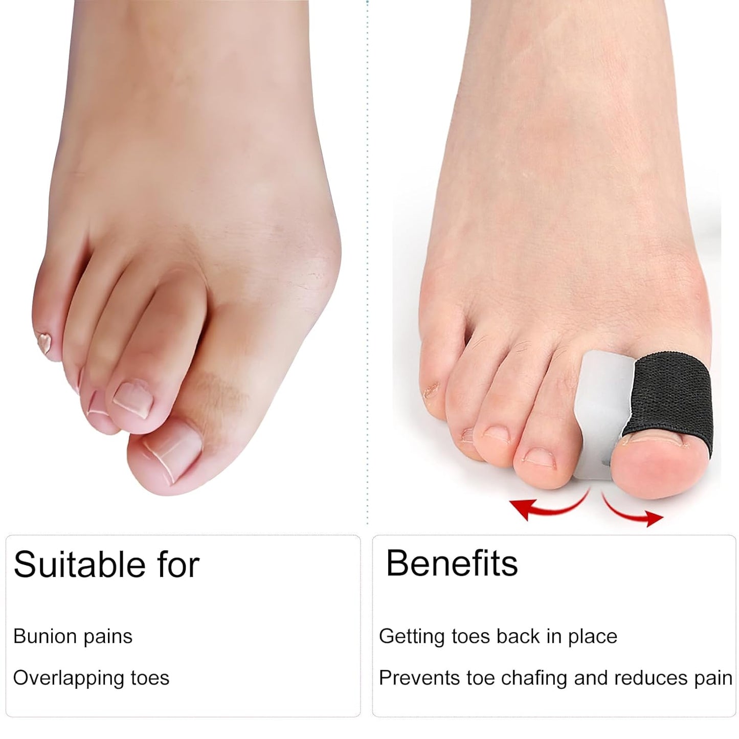 8 Pack Big Toe Spacers Toe Separators for Women Men, Sweat-Absorbent Elasticated Strap Designed and Non-Slip Toe Separators That Do Not Come Off Easily for Overlapping Toes Bunion Correct Toes