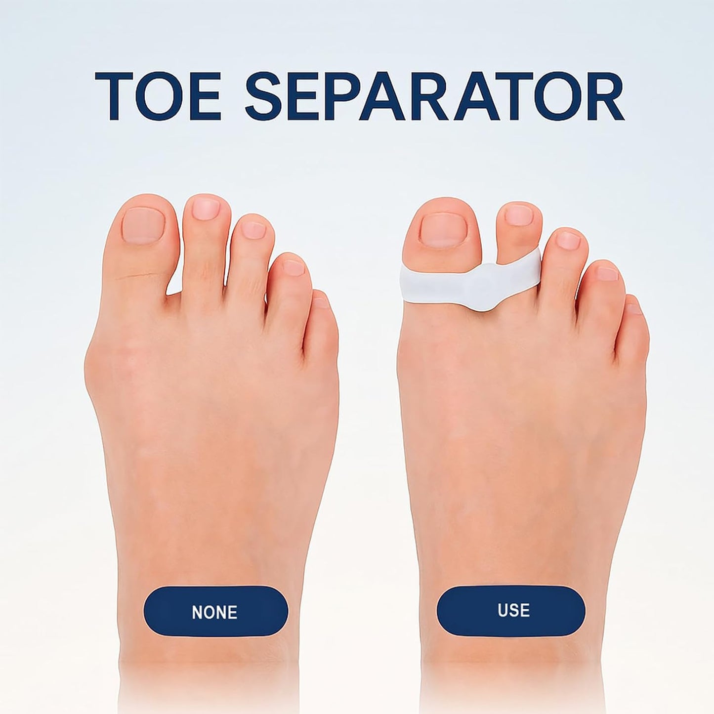 8pcs Silicone Toe Separators, Soft Toe Spacers Corrector with 2 Loops for Men & Women Straighten Overlapping Toes