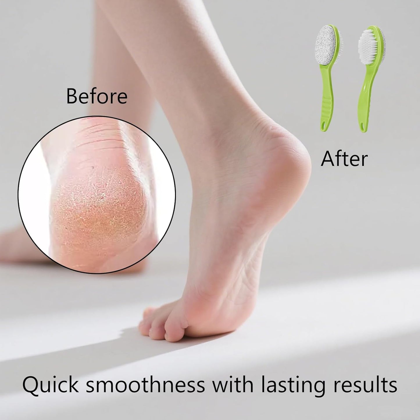 Foot Callus Remover, Double-Sided Pumice Stone Brush for Feet, 2 Pack Foot File Scrubber for Home Feet Care, Multi Purpose Pedicure Tools with Handle for Dead Skin Remover in Shower, Green