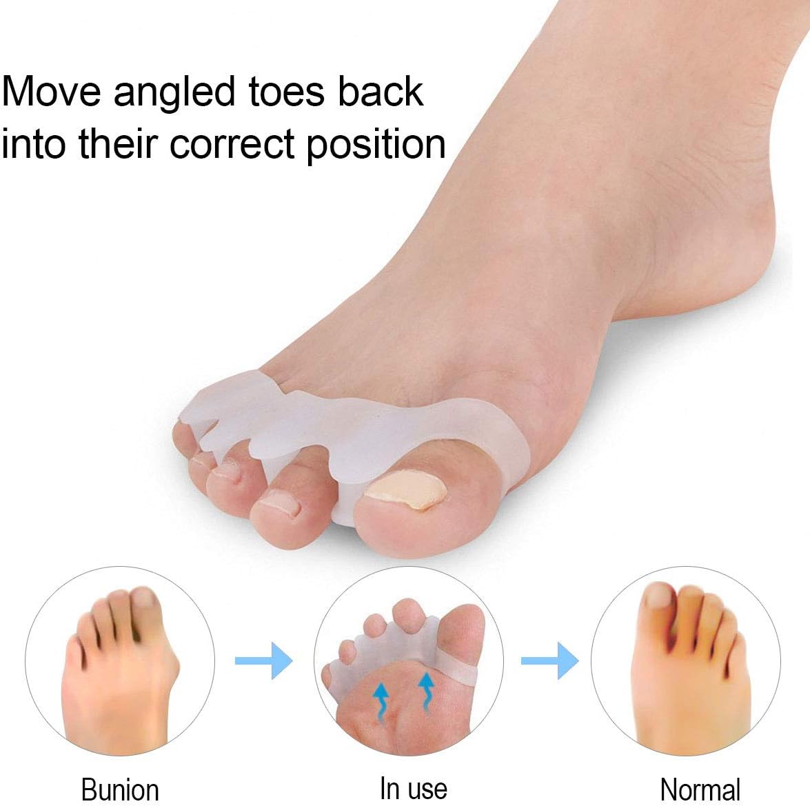 Toe Separators for Children, 2 Pairs Gel Toe Stretchers for Overlapping Toes, Kids Toe Separators Silicone, Toe Spacers Orthopedic Bunion Corrector, Hammer Straighten Correct Bunion Pain Toe for Kids