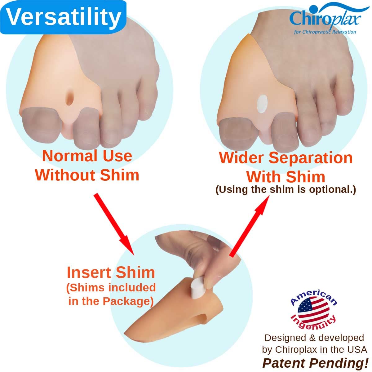 Chiroplax Bunion Corrector for Women & Men Relief Cushion Pads Hallux Valgus Guard Toe Separator Straightener Splint Protector Shield Spacer Sleeve Cover (4 Pads w/Shims, Small)
