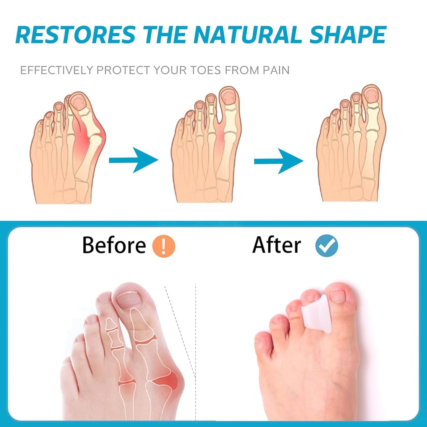 Hammer Toe Straightener Corrector - Toe Spacers Toe Separators for Bunion, Curled Toes, Hammertoes, Toe Corrector Toe Splint for Men and Women,6 Pack (Large Size)