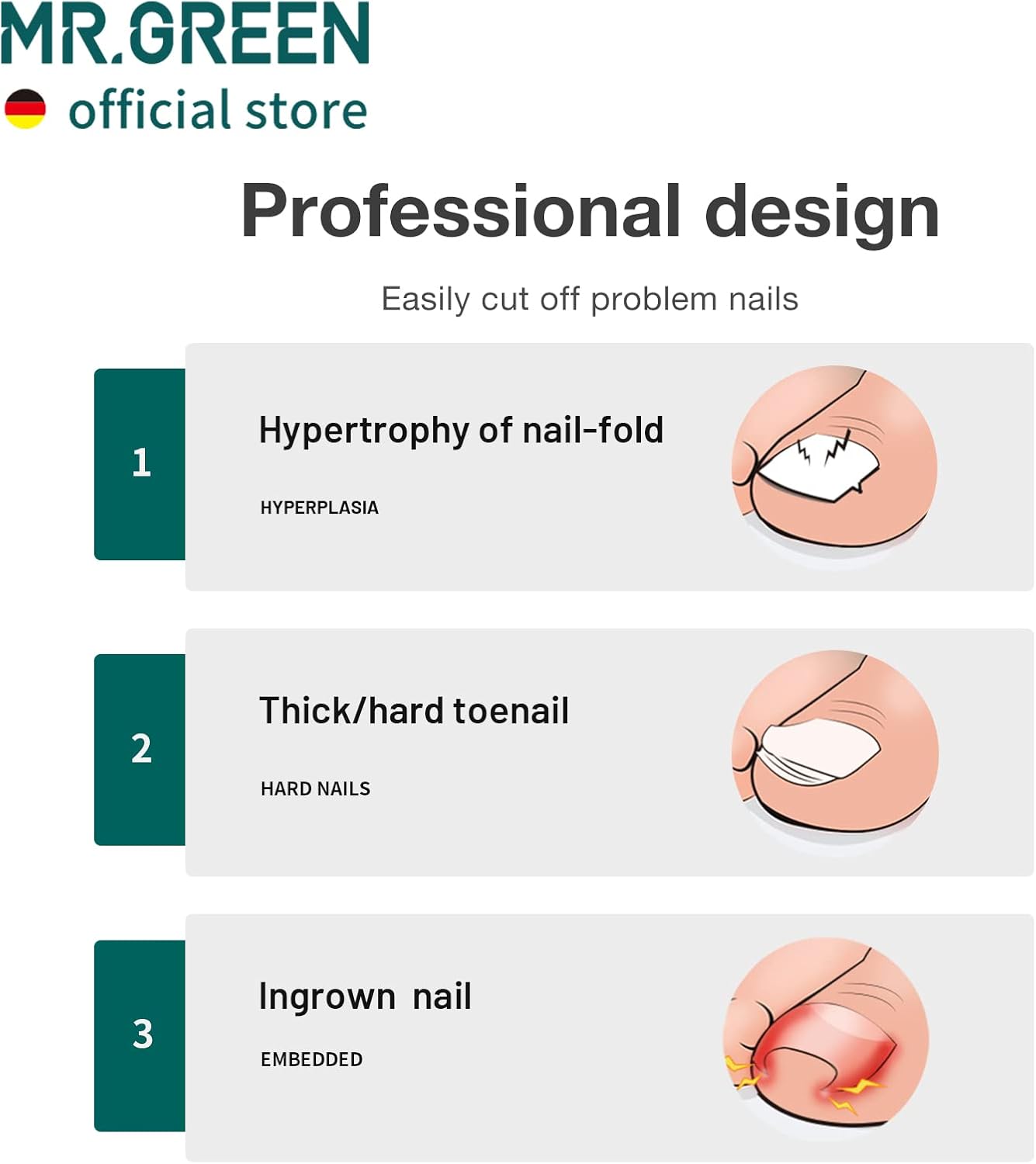 MR.GREEN Toenail Clippers Stainless Steel Ingrown Nail Cutter Thick and Hard Nails Pedicure Manicure Tools (Green+Nail Remover)