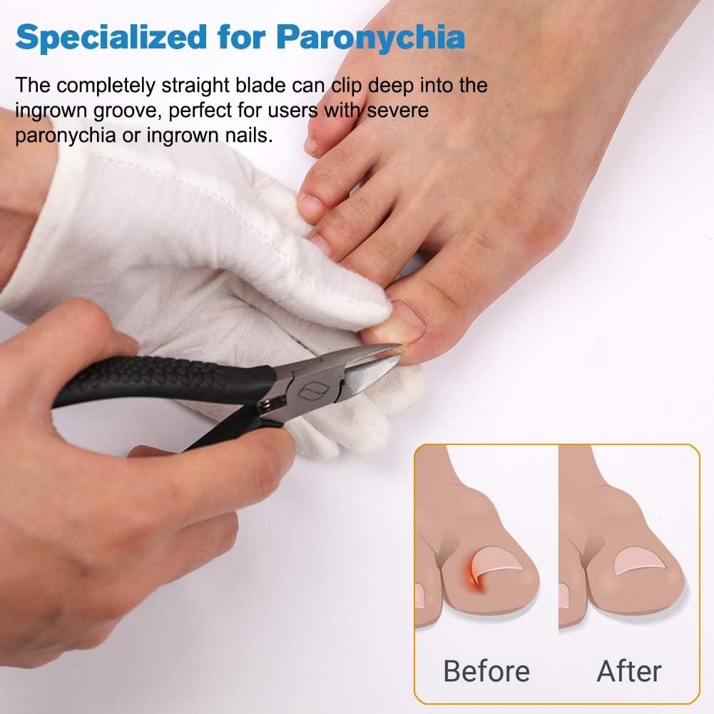 FERYES Straight Blade Toenail Clippers with Toenail Lifter and Fork - Toe Nail Clipper for Thick Toenails - 2 in 1 Ingrown Toenail Tools Kit