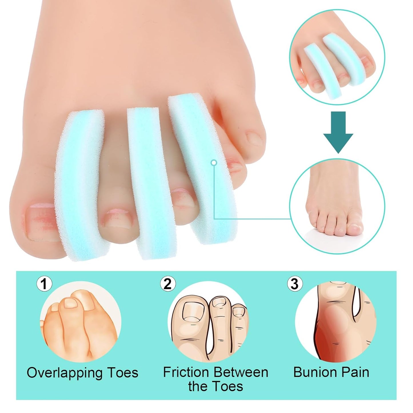 20 Pack Foam Toe Separator, Breathable Toe Spacers for Women Men, Toe Spreader to Reduce Friction and Relieves Corns Pain, Relieve Pain Caused by Bunions