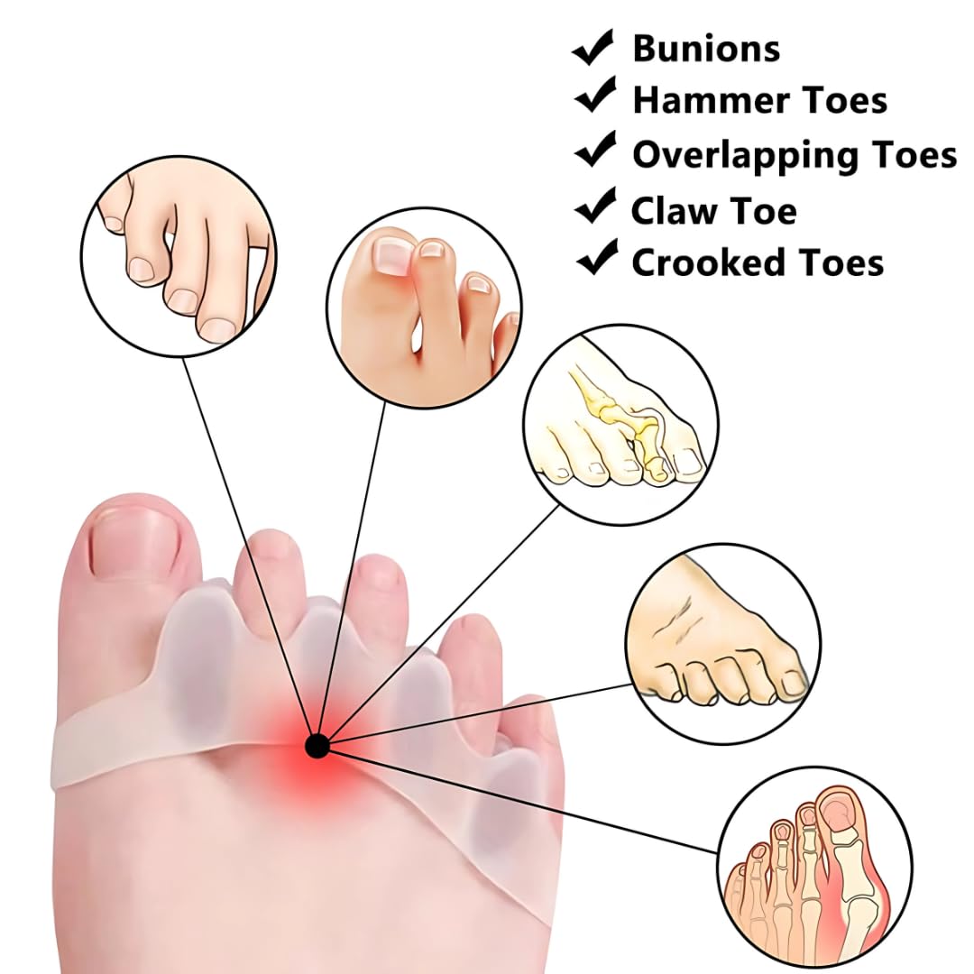 6 Pcs Silicone Toe Separators & Toe Spacers for Men & Women Gel Toe Separators for Overlapping Toes Bunions & Bent Toes Toe Spreader & Toe Stretcher for Alignment, Pain Relief Balance & Relaxation