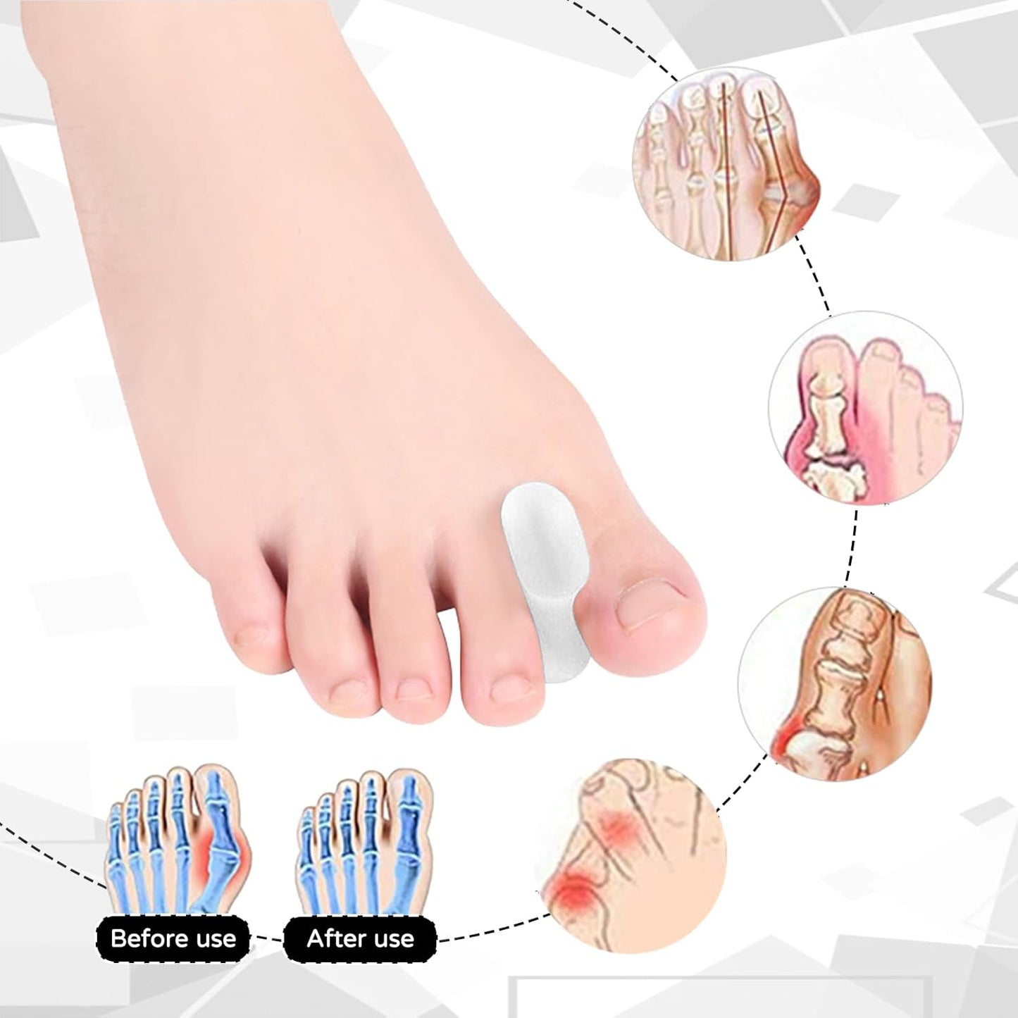 Gel Toe Separators,For Crooked Toes, Overlapping Toes, Hammertoe Corrector,For Women Men Toe Pain Relief(8 Pcs)