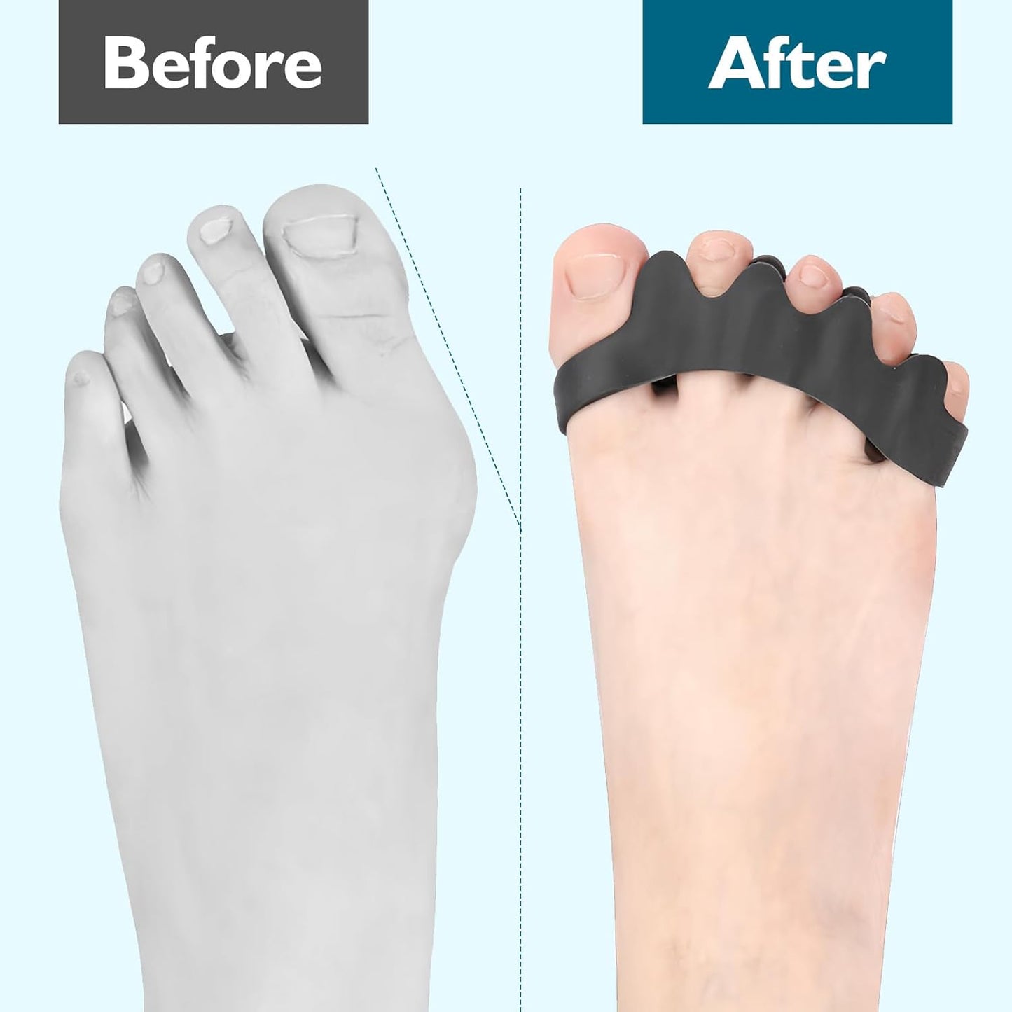 2Pcs Toe Spacers for Women and Men