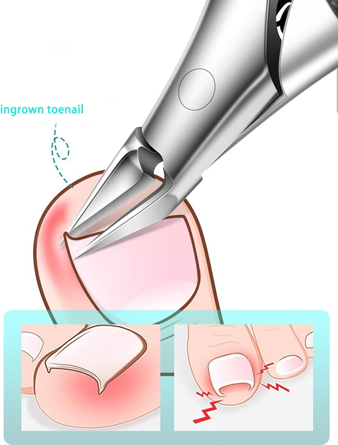 Upgrade Ingrown Toenail Clipper Professional Podiatrist Curved Blade Nail Clippers Tool for Seniors Thick Ingrown Nails for Men Women