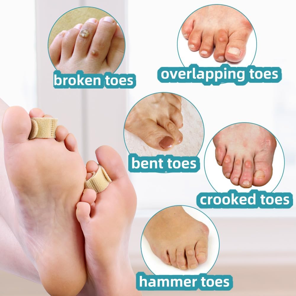 Toe Separators for Overlapping Toes, Bunions, Big Toe Alignment, Corrector and Spacer, Reusable Fabric Buddy Wraps for Broken Toes, Hammertoe Straightener (White)