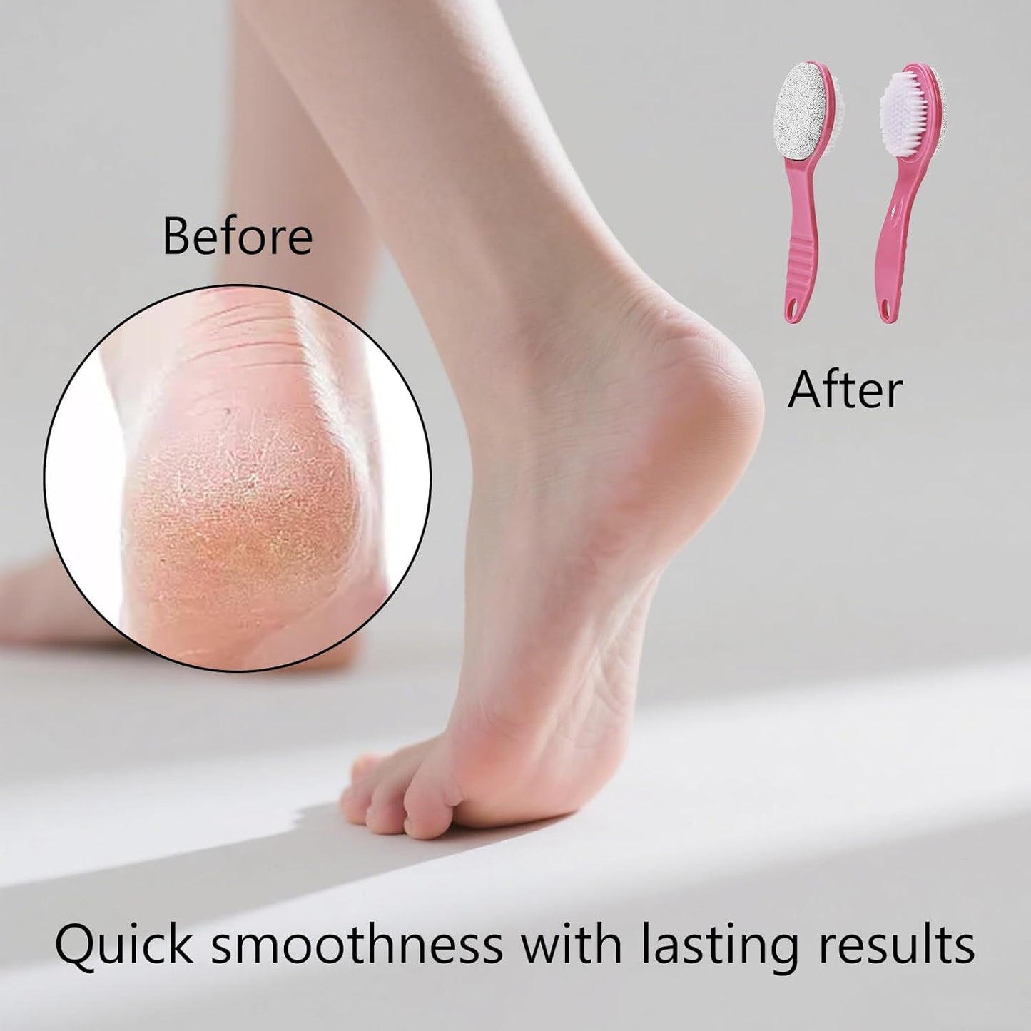 Foot Callus Remover, Double-Sided Pumice Stone Brush for Feet, 2 Pack Foot File Scrubber for Home Feet Care, Multi Purpose Pedicure Tools with Handle for Dead Skin Remover, Rose Pink