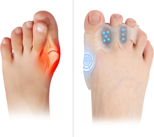 Toe Spacers & Bunion Corrector for Men&Women|Toe Separators,Corn Callus Removers|Hammer Toe Straightener|Bunion Relief|Overlapping Toes Separators|Corn Pads for Toes|1 Pair (Large)